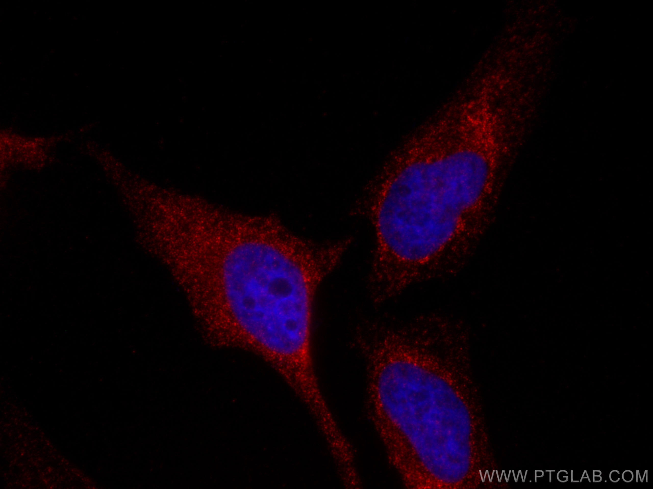 IF Staining of HeLa using CL594-66026