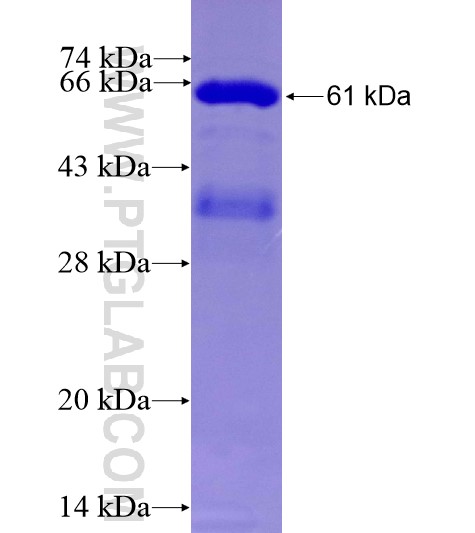 MCL1 fusion protein Ag10397 SDS-PAGE