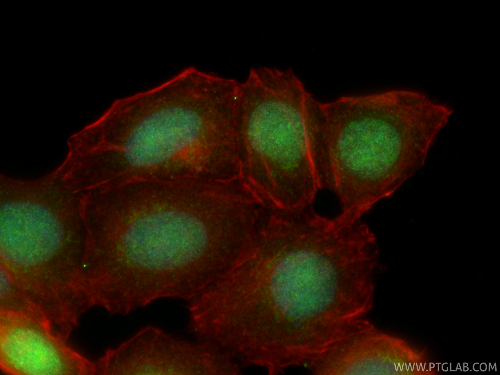 IF Staining of MCF-7 using 10513-1-AP
