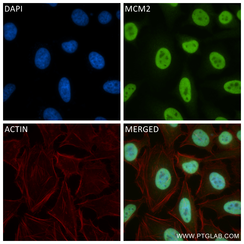 IF Staining of HeLa using 84511-2-RR (same clone as 84511-2-PBS)