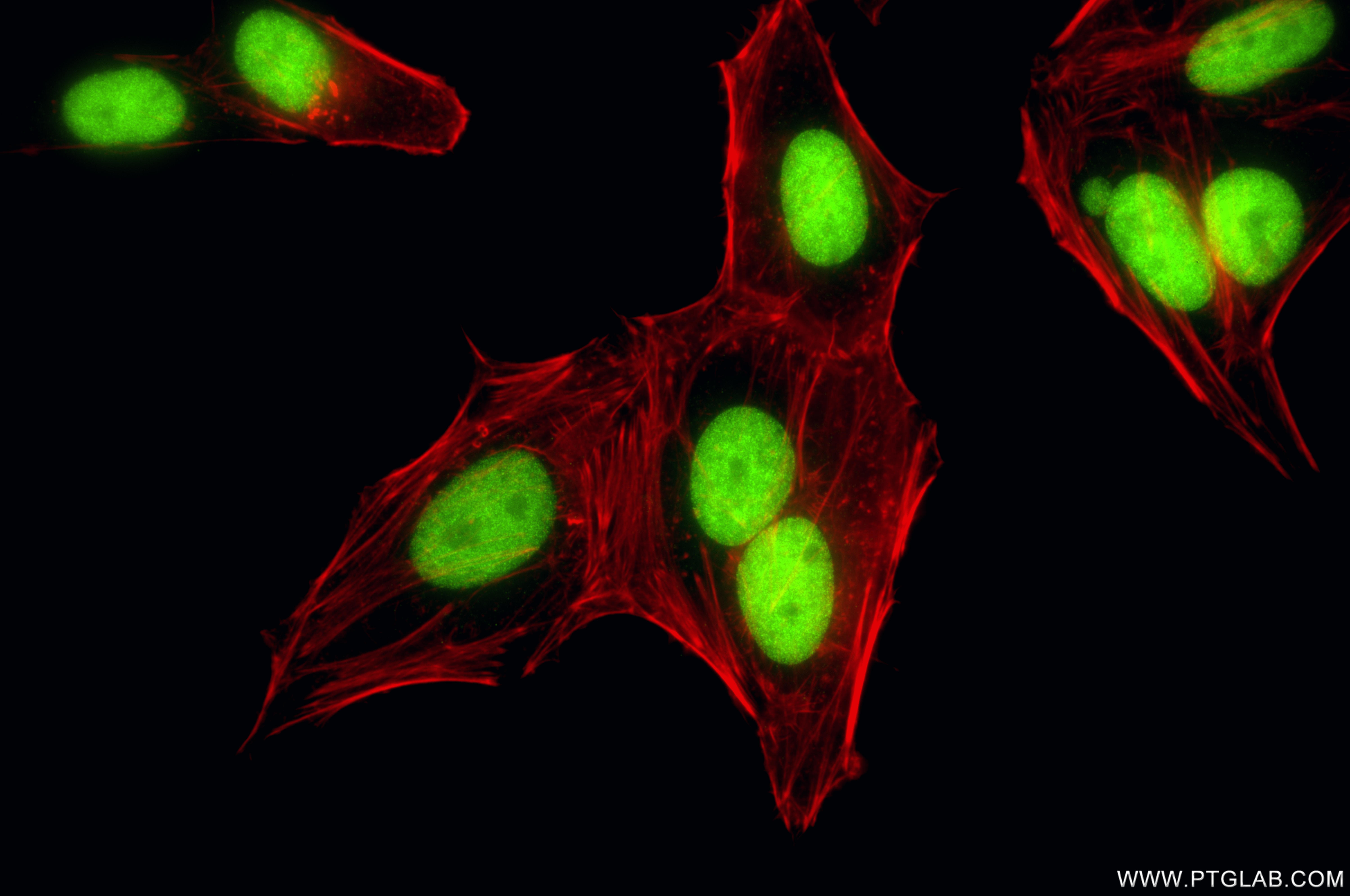 IF Staining of HepG2 using 84511-9-RR (same clone as 84511-9-PBS) IF Staining of HepG2 using 84511-9-RR (same clone as 84511-9-PBS)