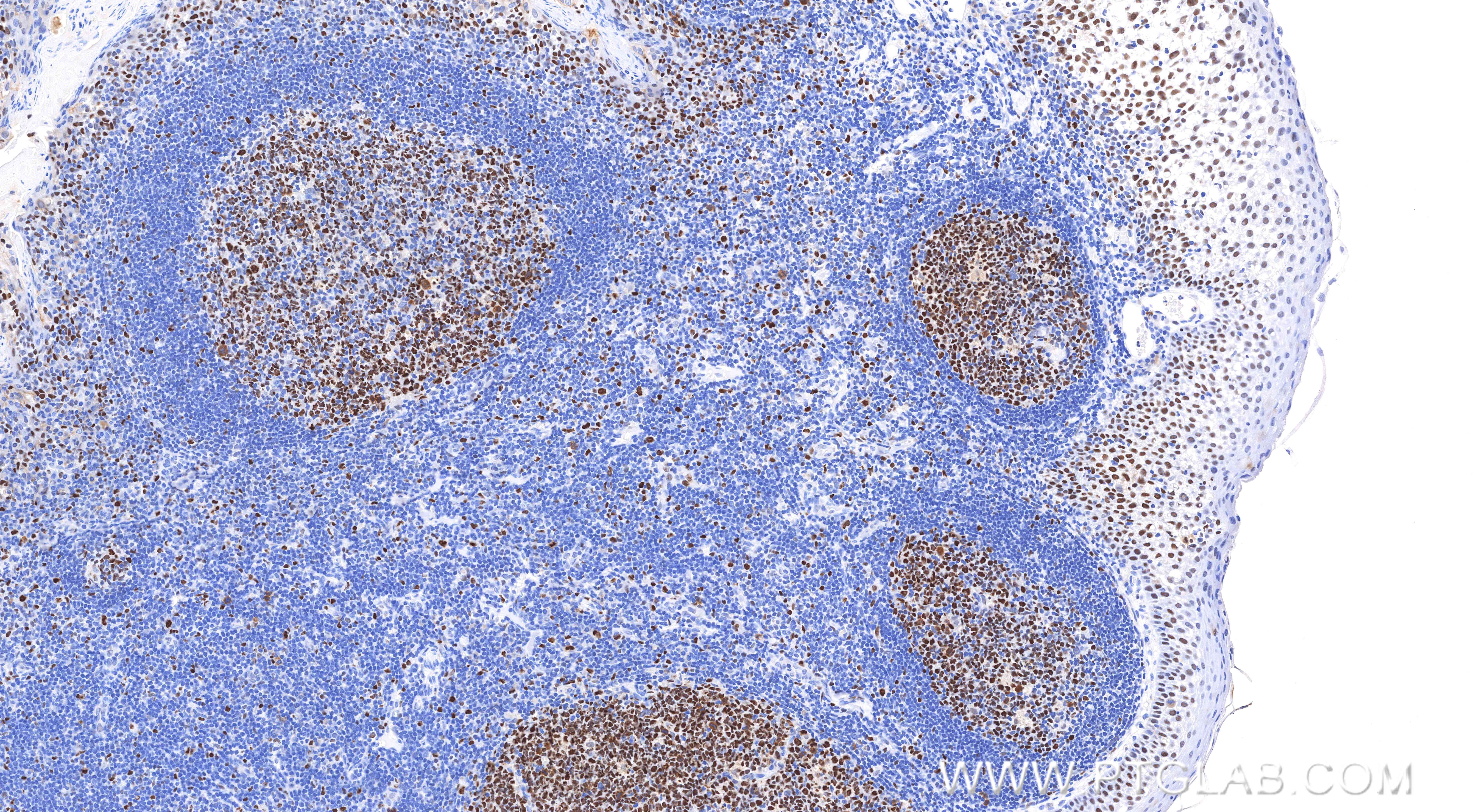 IHC staining of human tonsil using 84511-9-RR (same clone as 84511-9-PBS) IHC staining of human tonsil using 84511-9-RR (same clone as 84511-9-PBS)