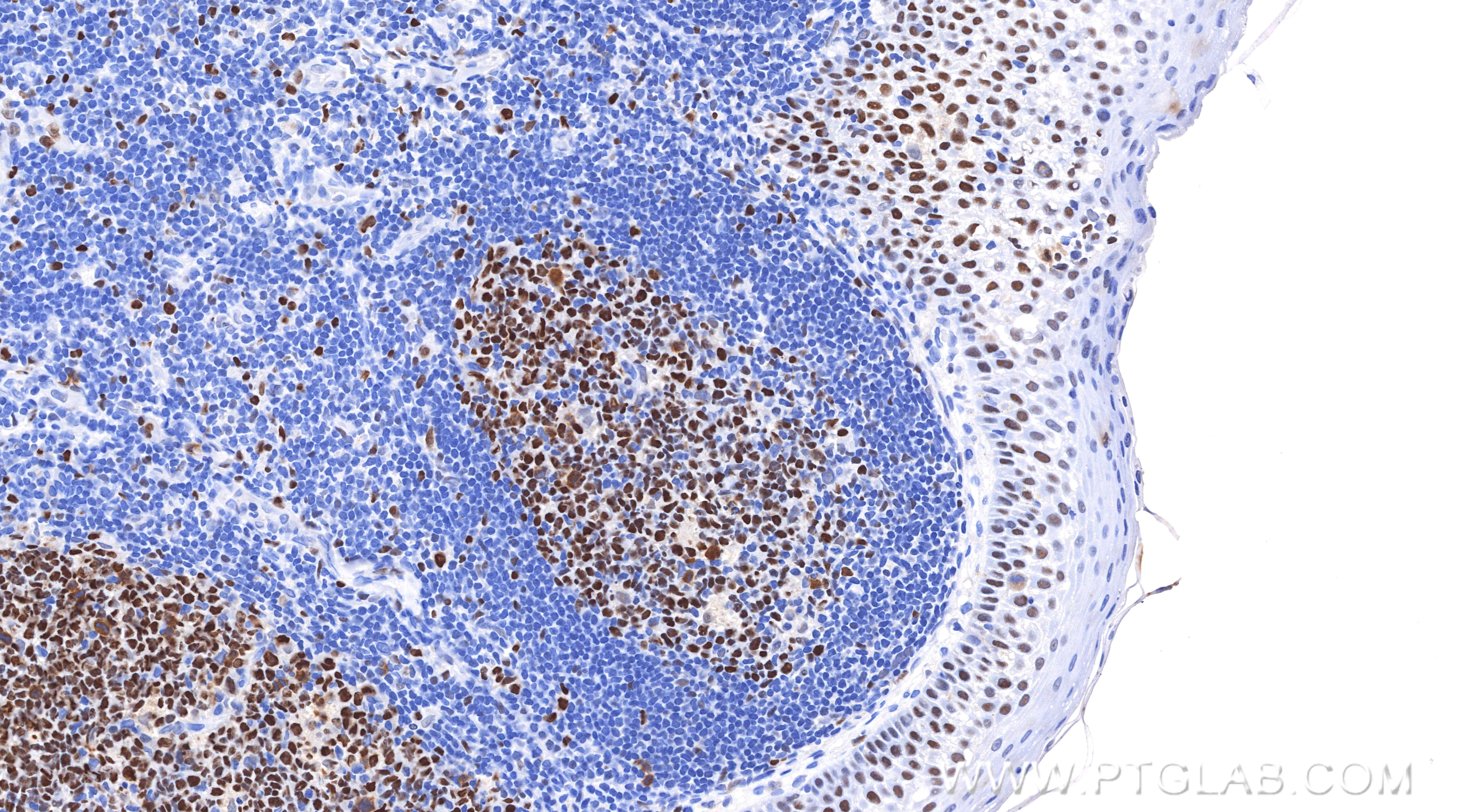 IHC staining of human tonsil using 84511-9-RR (same clone as 84511-9-PBS) IHC staining of human tonsil using 84511-9-RR (same clone as 84511-9-PBS)