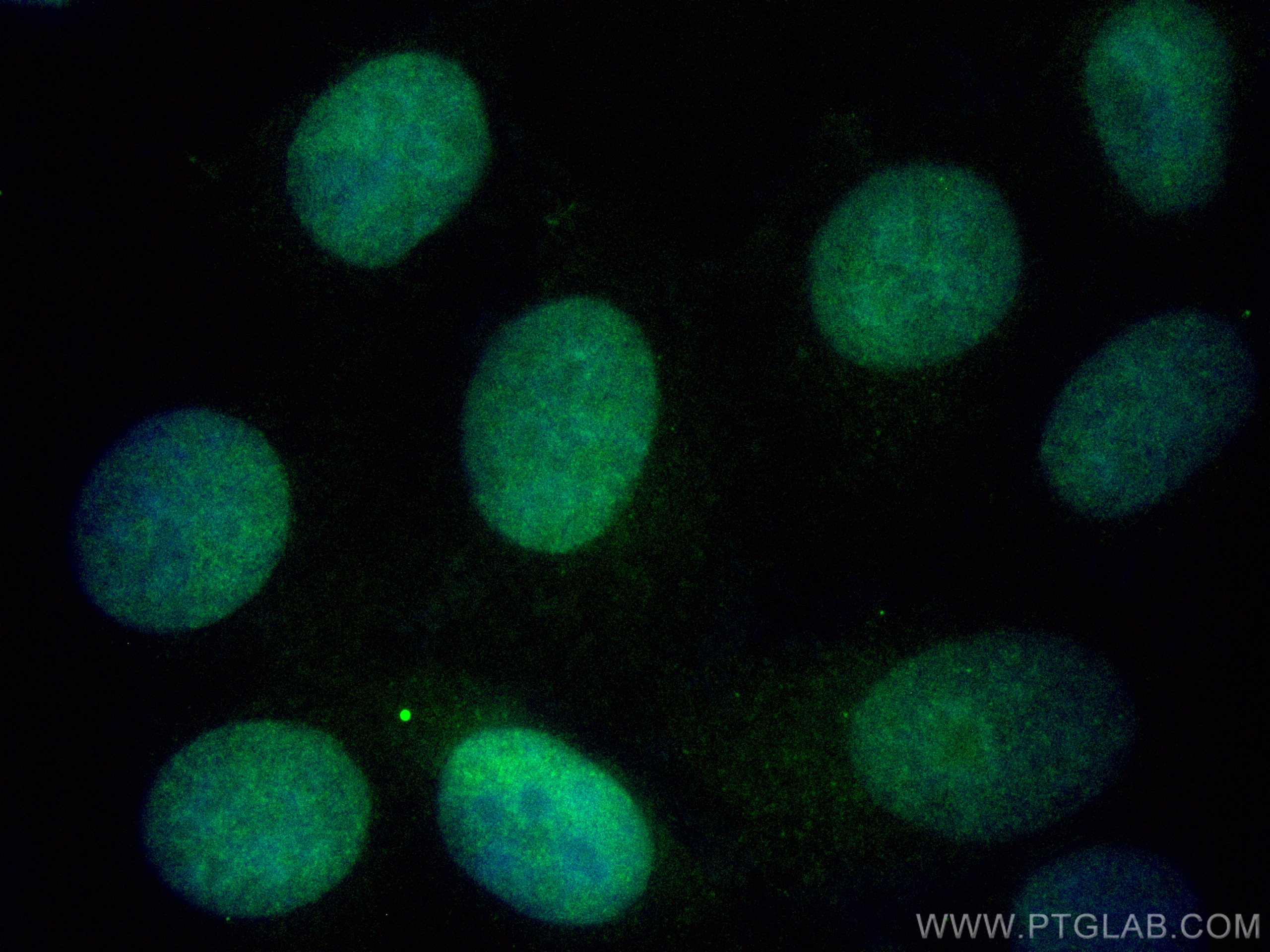 IF Staining of MCF-7 using CL488-10513