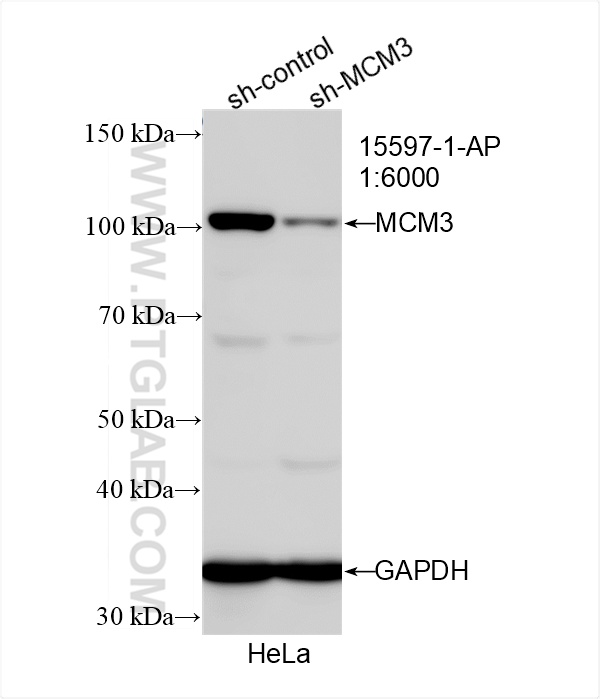 WB analysis of HeLa using 15597-1-AP WB analysis of HeLa using 15597-1-AP