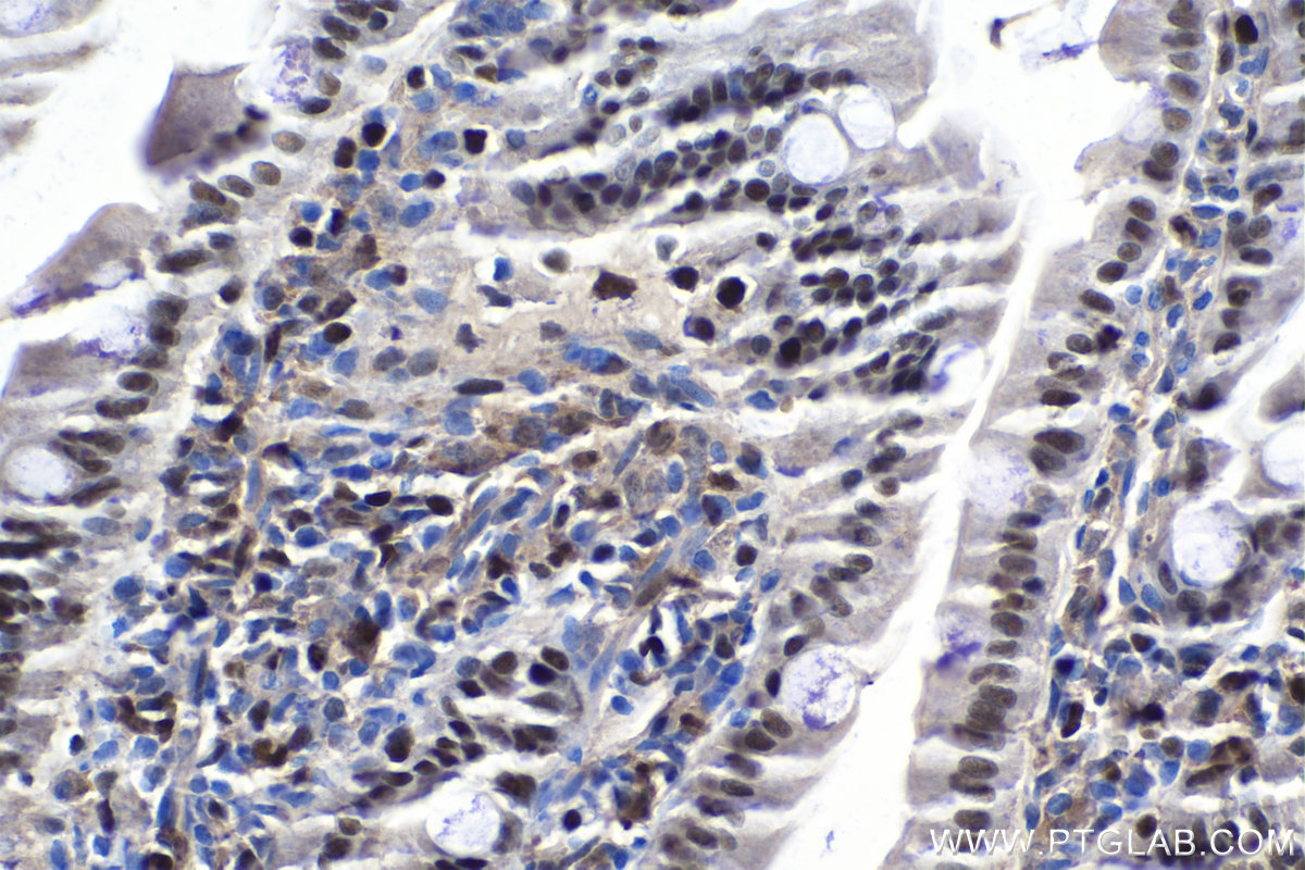 IHC staining of rat colon using 13043-1-AP