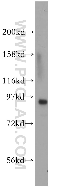 WB analysis of HeLa using 13043-1-AP