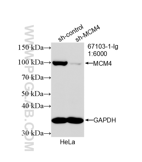 WB analysis of HeLa using 67103-1-Ig