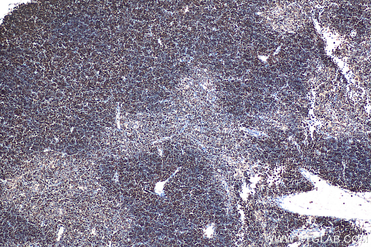 Immunohistochemical analysis of paraffin-embedded mouse thymus tissue slide using 11703-1-AP (MCM5 antibody) at dilution of 1:1000 (under 10x lens). Heat mediated antigen retrieval with Tris-EDTA buffer (pH 9.0). IHC staining of mouse thymus using 11703-1-AP