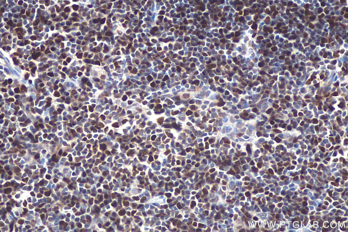 Immunohistochemical analysis of paraffin-embedded mouse thymus tissue slide using 11703-1-AP (MCM5 antibody) at dilution of 1:1000 (under 40x lens). Heat mediated antigen retrieval with Tris-EDTA buffer (pH 9.0). IHC staining of mouse thymus using 11703-1-AP