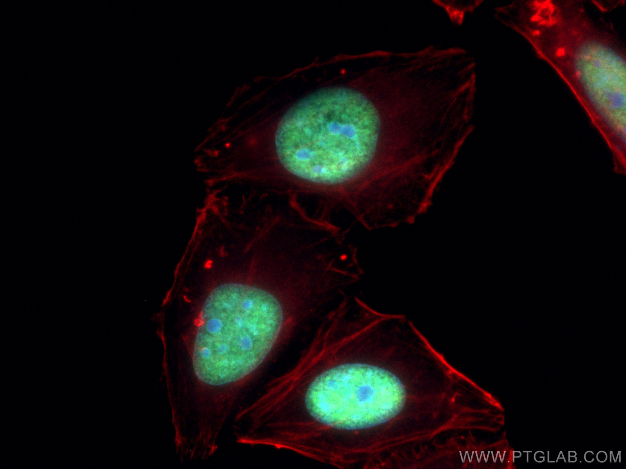 IF Staining of HepG2 using 67989-1-Ig (same clone as 67989-1-PBS)