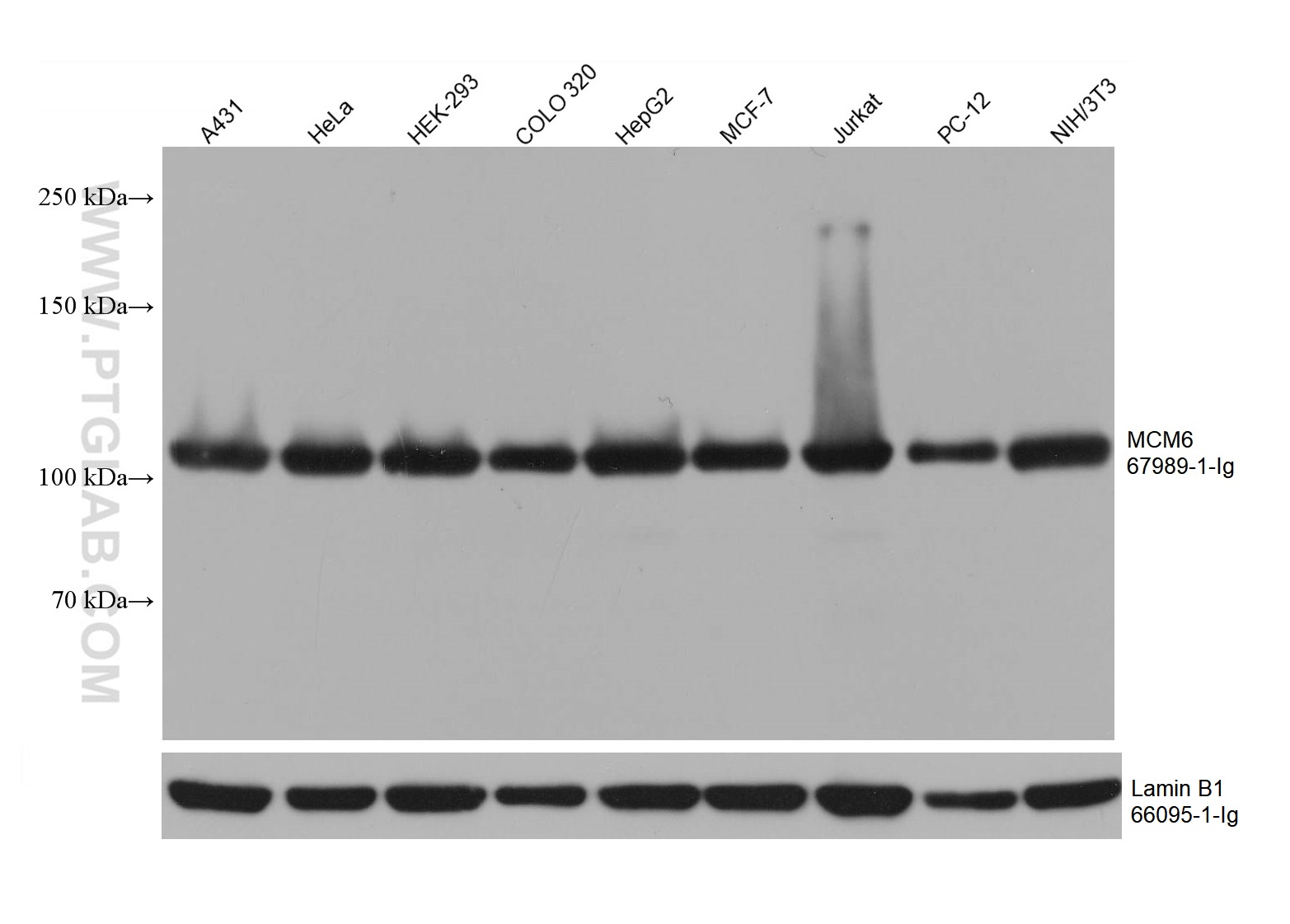 WB analysis using 67989-1-Ig (same clone as 67989-1-PBS)