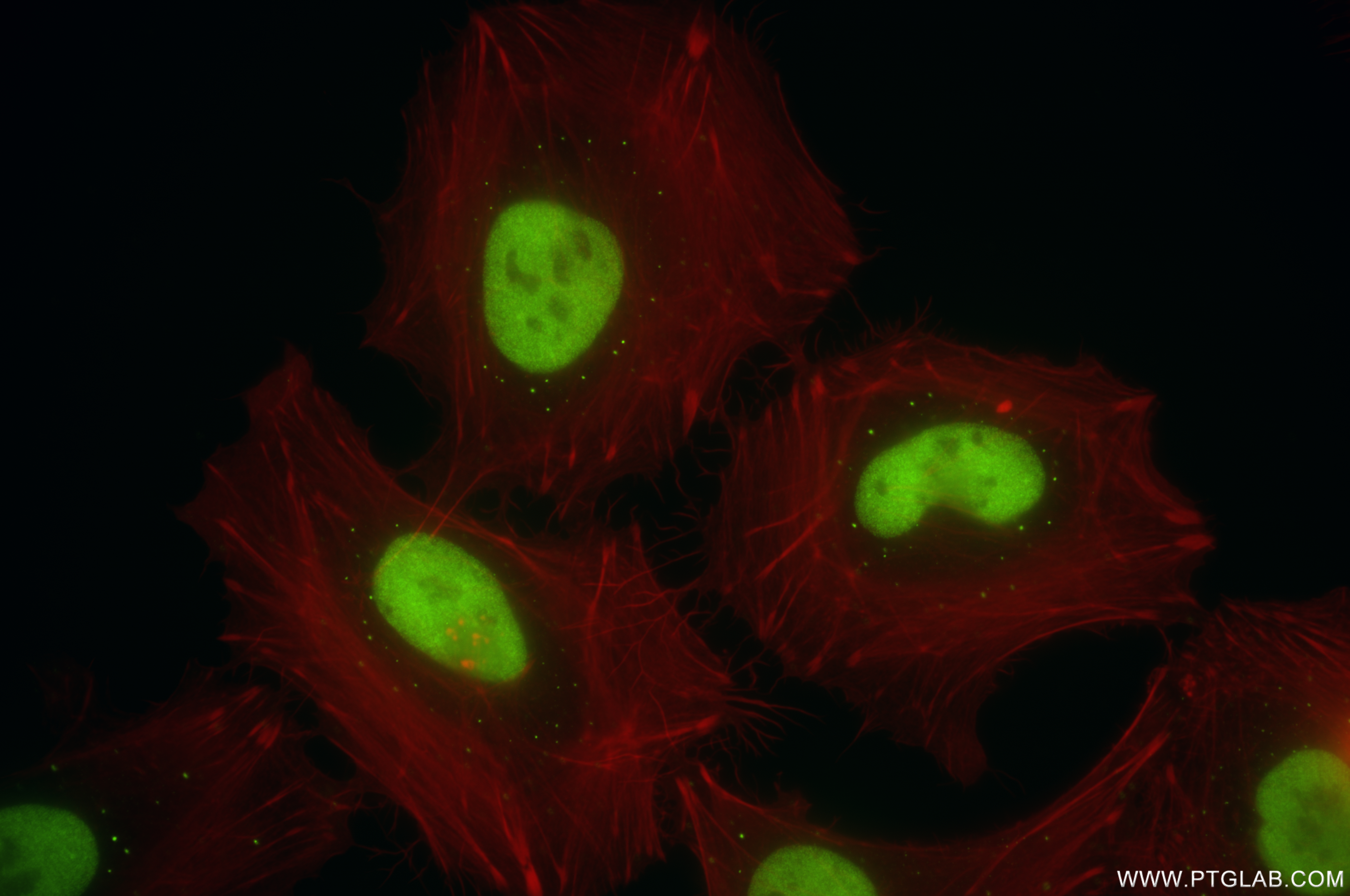 IF Staining of HeLa using 86950-1-RR IF Staining of HeLa using 86950-1-RR