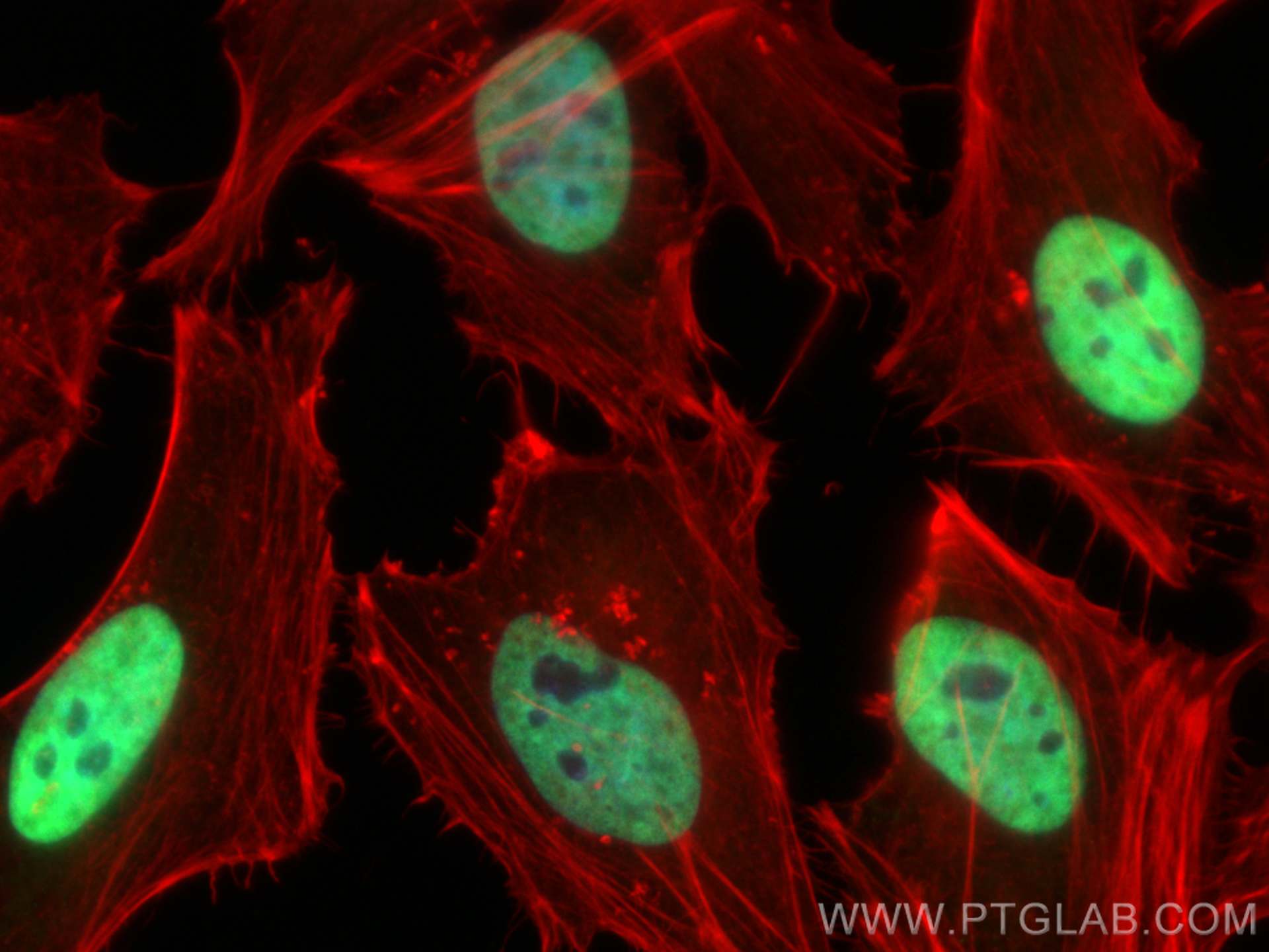 IF Staining of HeLa using CL488-13347