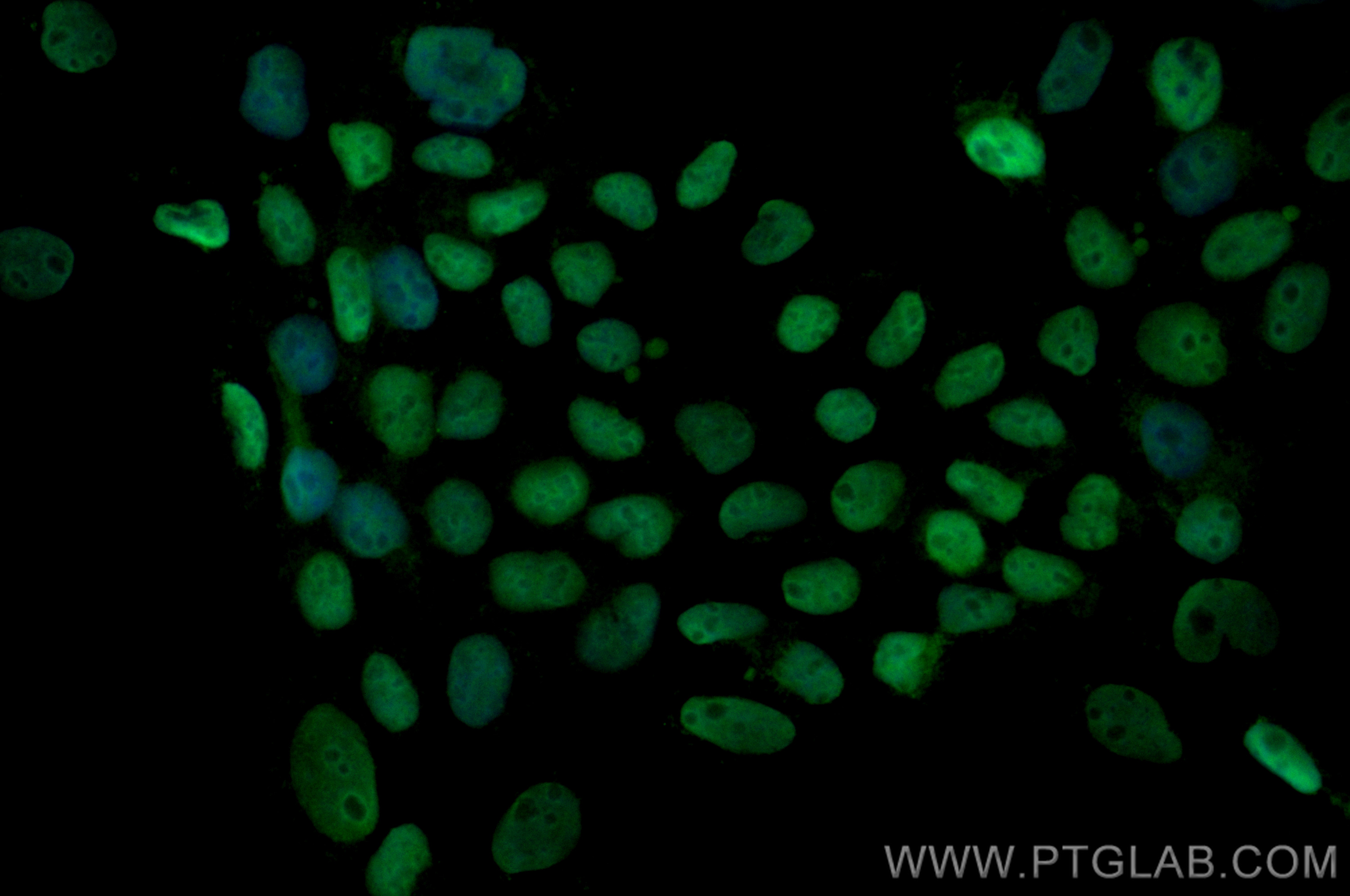 IF Staining of A431 using CL488-11225