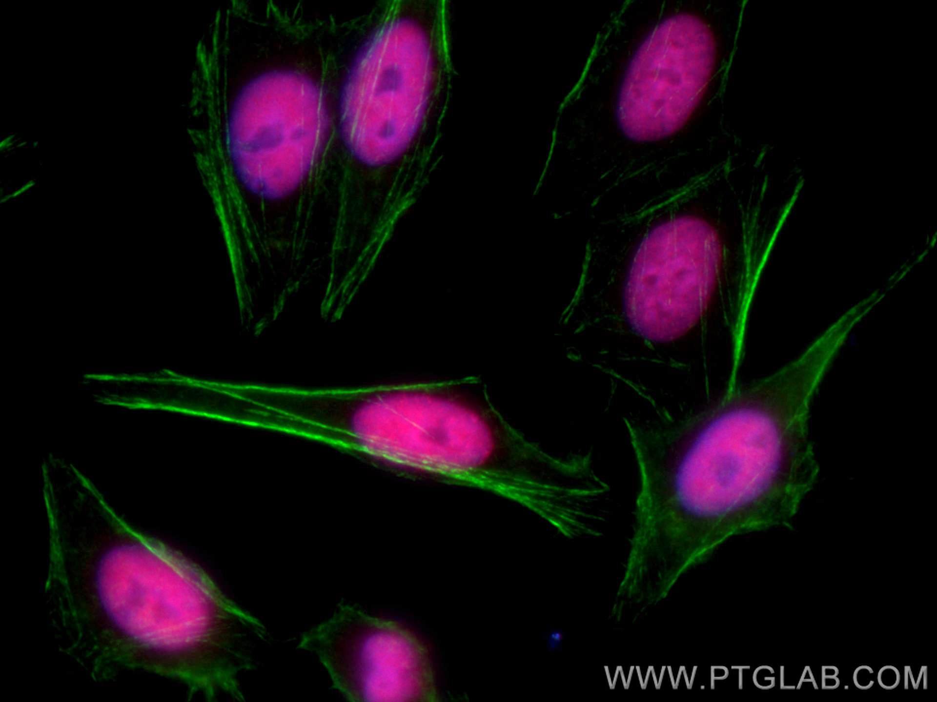 IF Staining of HepG2 using CL594-67446