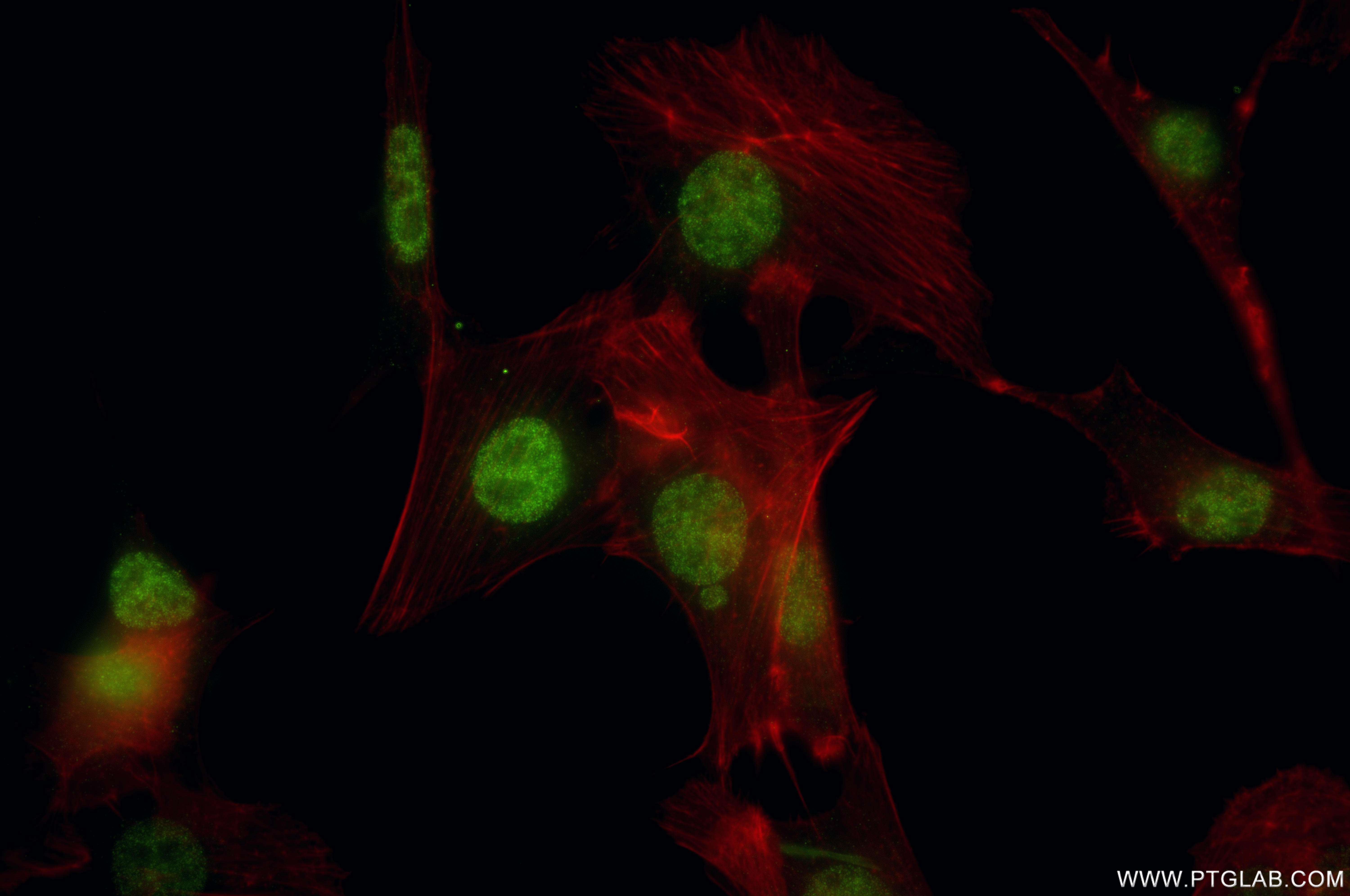 IF Staining of NIH/3T3 using 87212-1-RR (same clone as 87212-1-PBS)