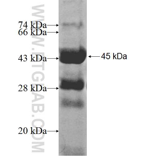 MCM8 fusion protein Ag8430 SDS-PAGE MCM8 fusion protein Ag8430 SDS-PAGE