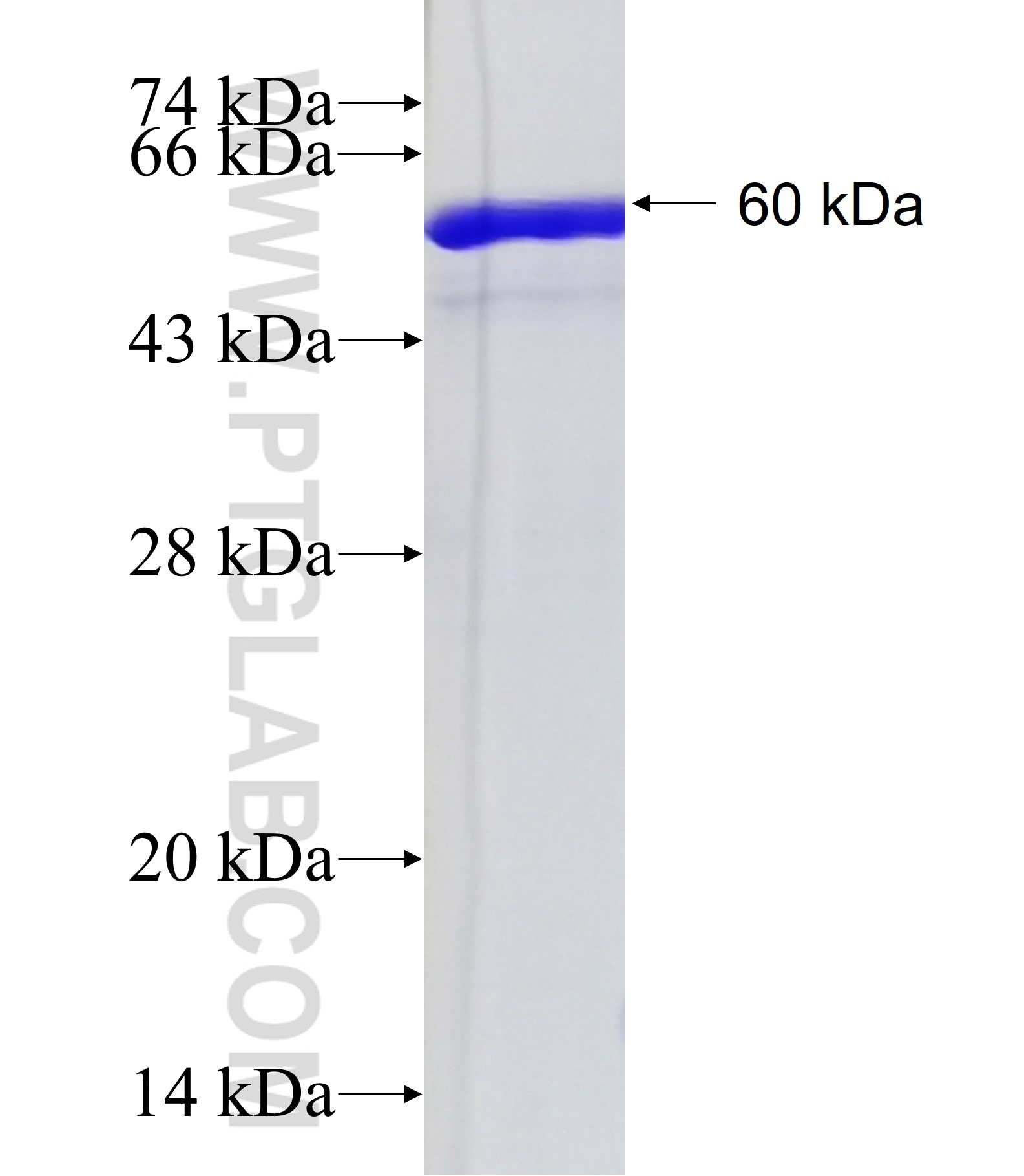 MCM9 fusion protein Ag4108 SDS-PAGE