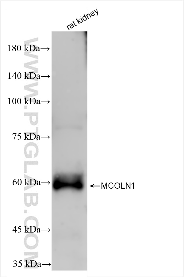 WB analysis of rat kidney using 85339-1-RR (same clone as 85339-1-PBS)