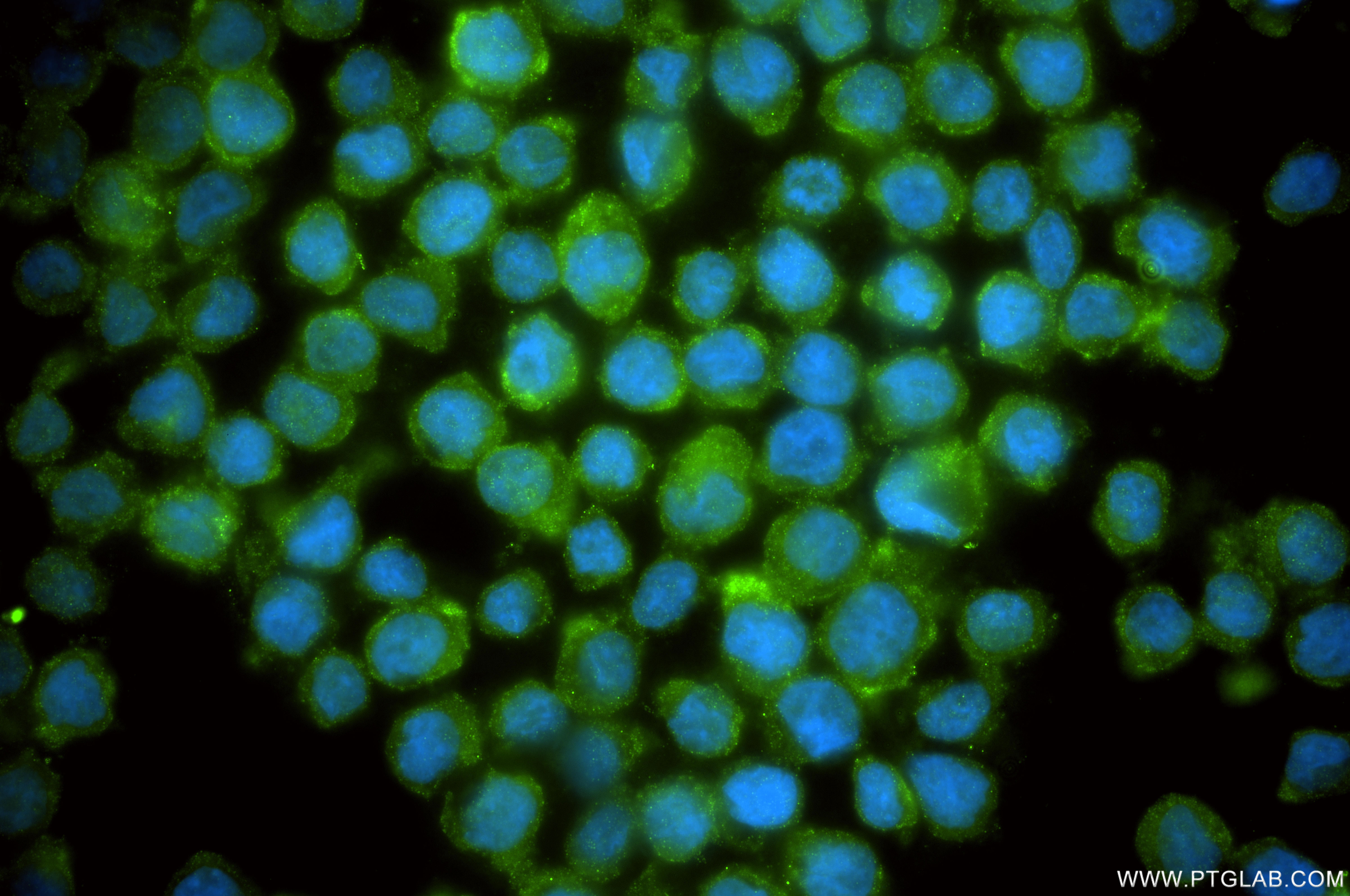Immunofluorescent analysis of (4% PFA) fixed THP-1 cells using MCOLN2 antibody (<a class='green' href='/productredirect?CatalogNo=98650-1-RR' target='_blank'>98650-1-RR</a>, Clone: 251091D10 ) at dilution of 1:200 and CoraLite®488-Conjugated Goat Anti-Rabbit IgG(H+L) (<a class='green' href='/productredirect?CatalogNo=SA00013-2' target='_blank'>SA00013-2</a>). This data was developed using the same antibody clone with 98650-1-PBS in a different storage buffer formulation. IF Staining of THP-1 using 98650-1-RR (same clone as 98650-1-PBS)