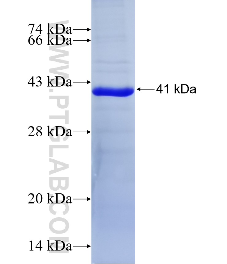 MCOLN2 fusion protein Ag12894 SDS-PAGE MCOLN2 fusion protein Ag12894 SDS-PAGE