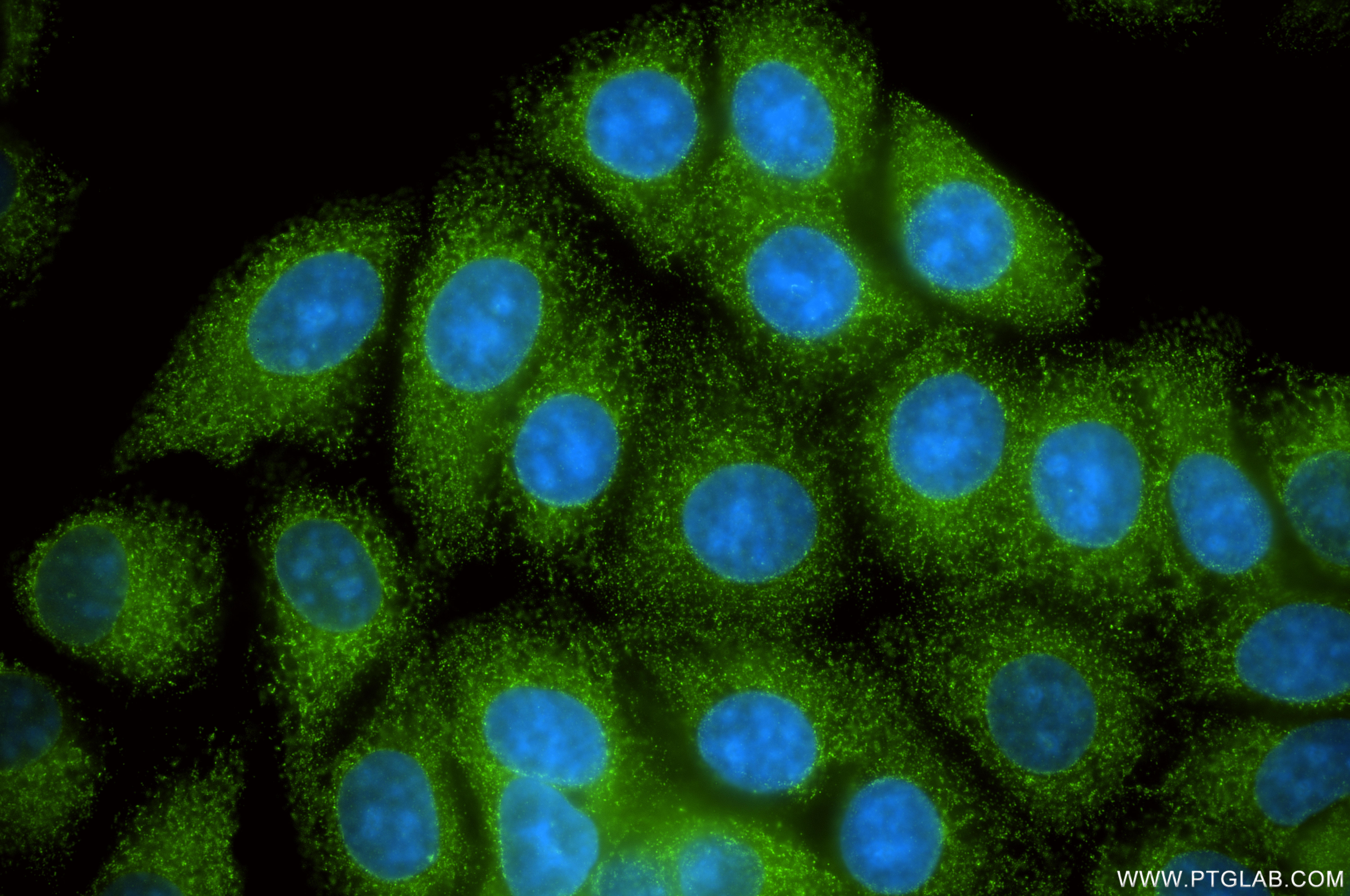 Immunofluorescent analysis of (-20°C Methanol) fixed MCF-7 cells using MCOLN3 antibody (86202-1-RR, Clone: 250799F8 ) at dilution of 1:400 and CoraLite®488-Conjugated Goat Anti-Rabbit IgG(H+L) (<a class='green' href='/productredirect?CatalogNo=SA00013-2' target='_blank'>SA00013-2</a>). IF Staining of MCF-7 using 86202-1-RR