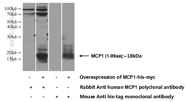 MCP1 Polyclonal antibody