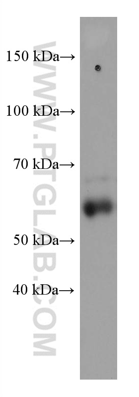 WB analysis of ROS1728 using 60215-1-Ig