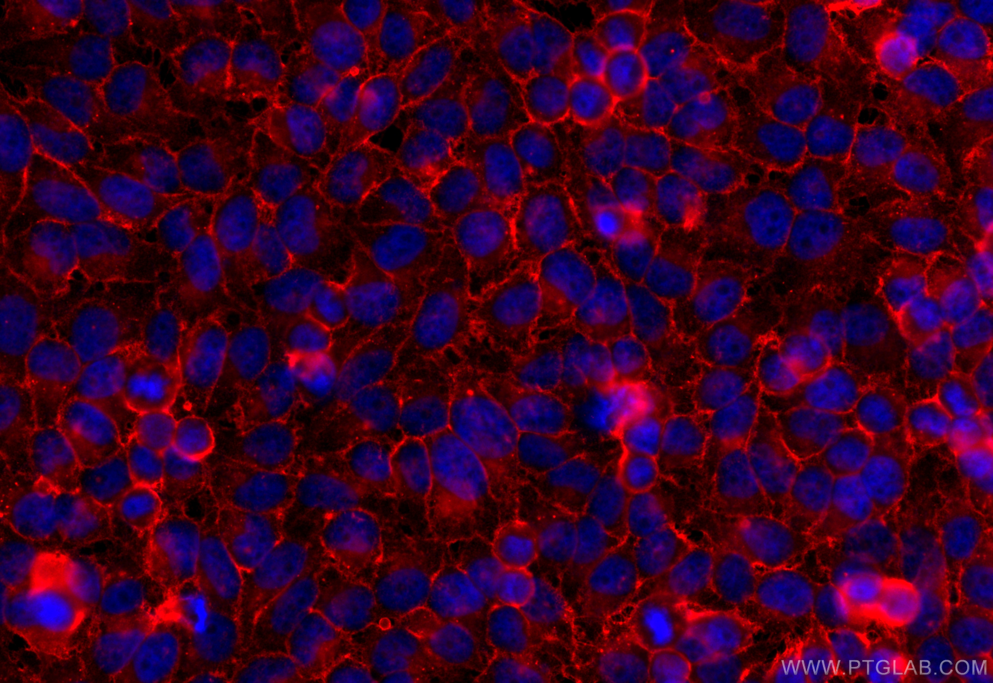 IF Staining of HeLa using 20139-1-AP