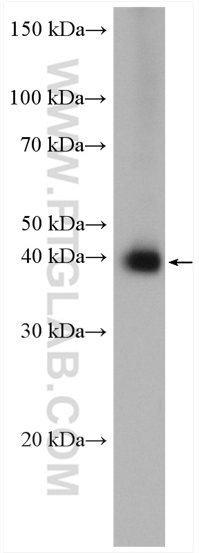 BxPC-3 cells were subjected to SDS PAGE followed by western blot with 20139-1-AP (MCT1 antibody) at dilution of 1:5000 incubated at room temperature for 1.5 hours. WB analysis of BxPC-3 using 20139-1-AP