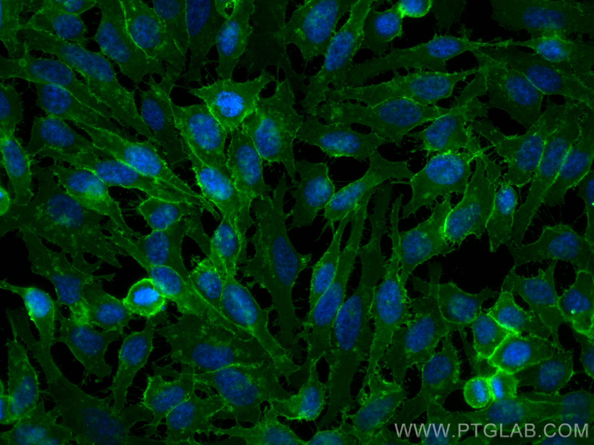IF Staining of HeLa using CL488-20139