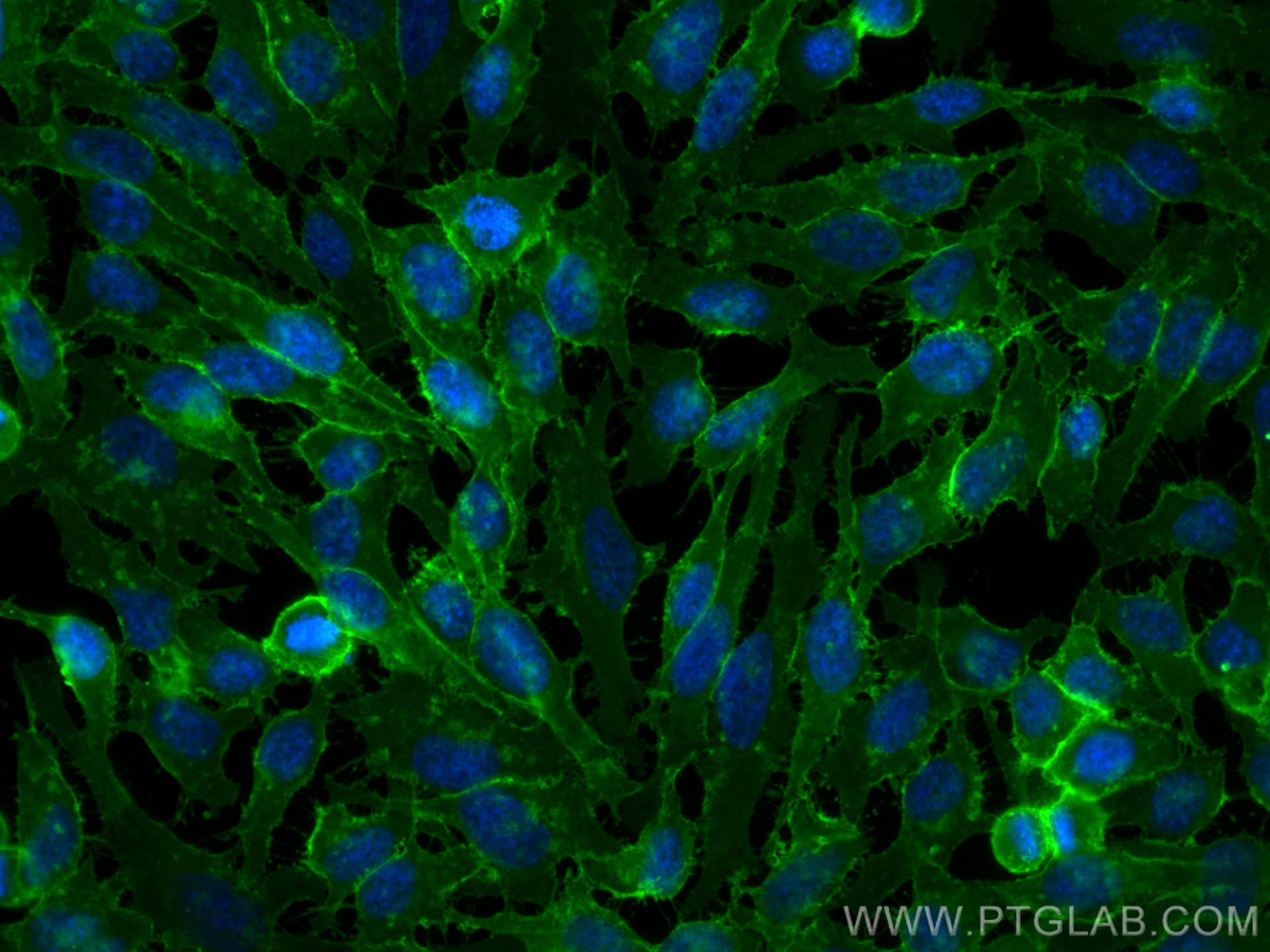 IF Staining of HeLa using CL488-20139