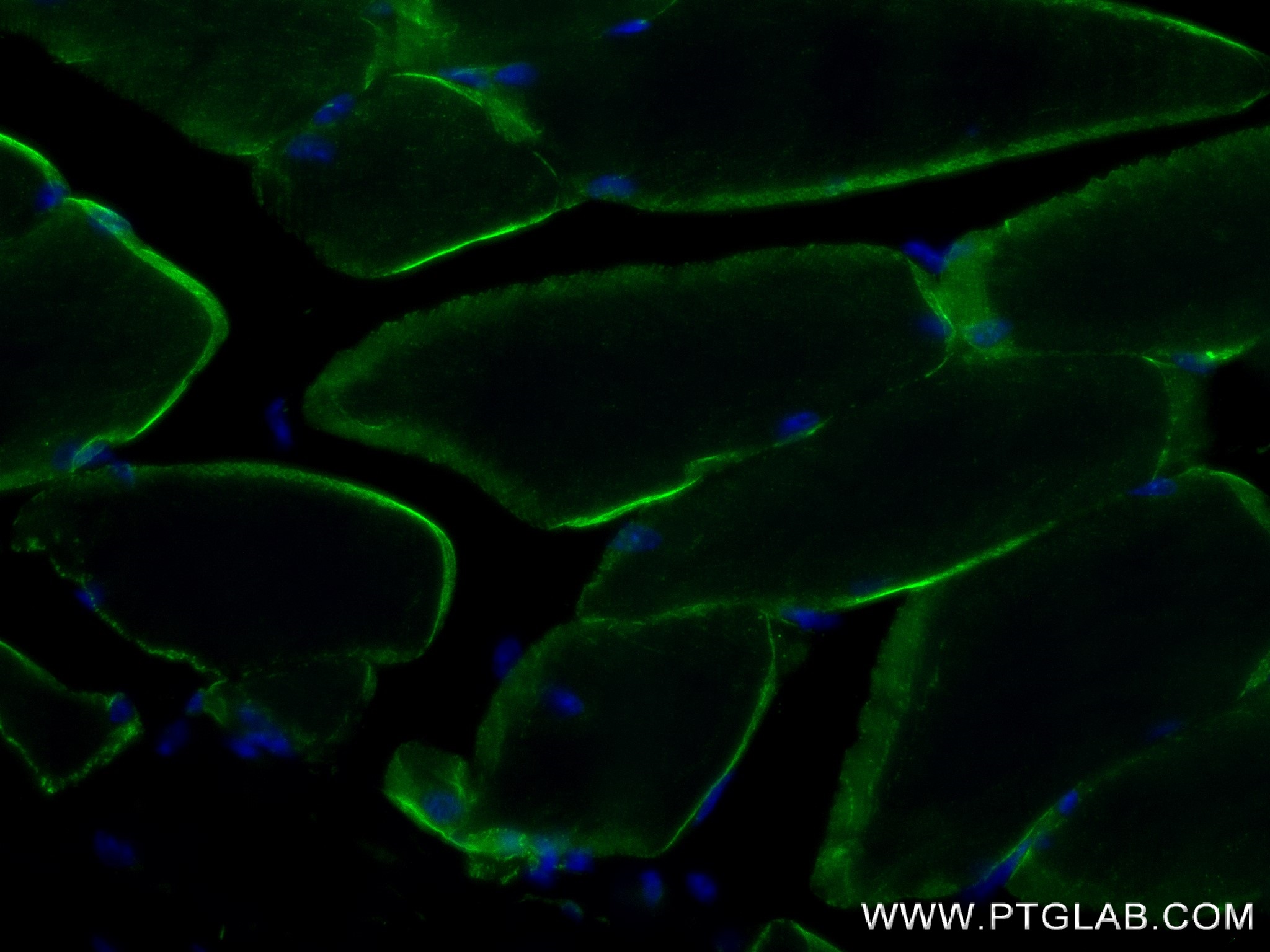 IF Staining of mouse skeletal muscle using 84797-4-RR