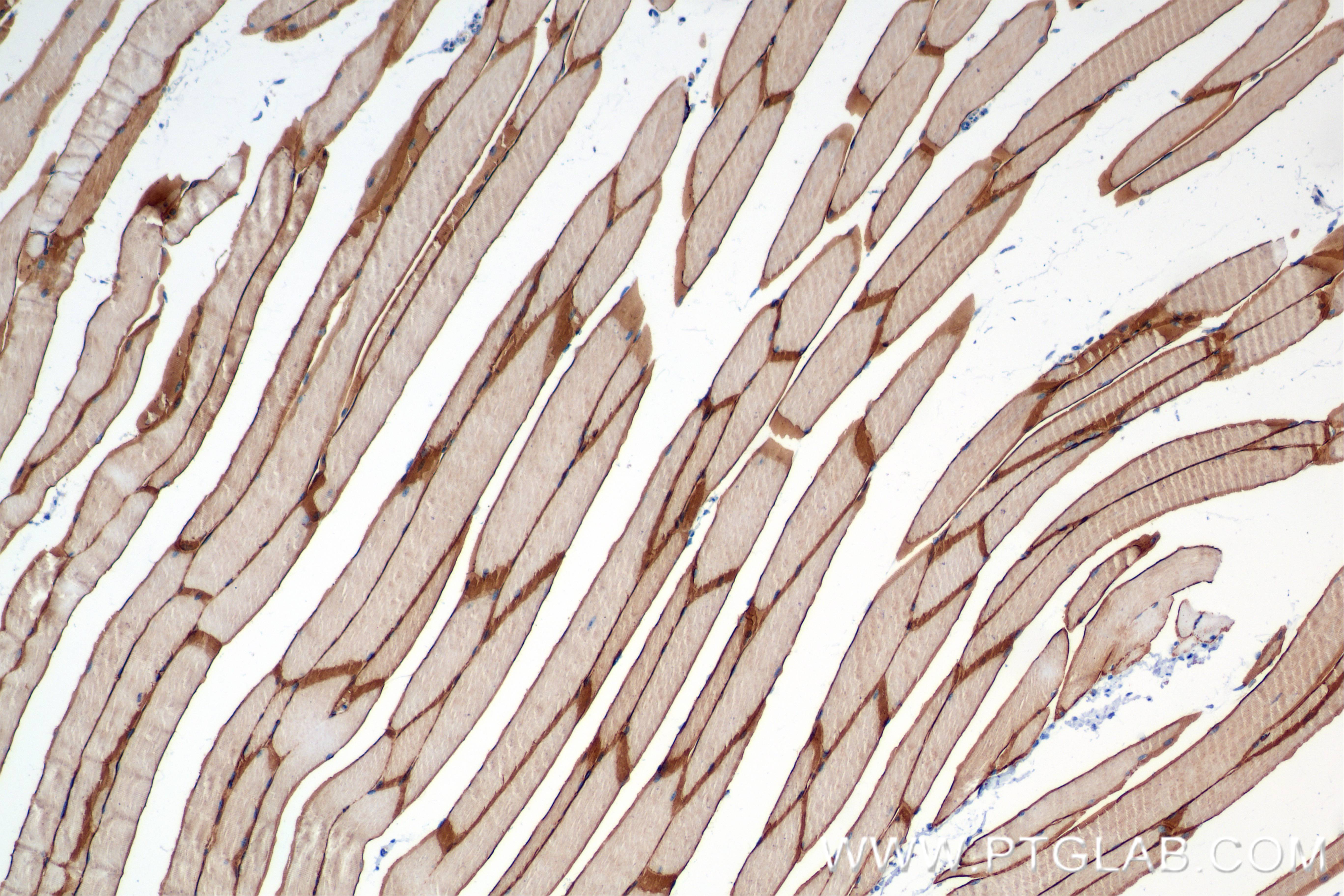 IHC staining of mouse skeletal muscle using 84797-4-RR