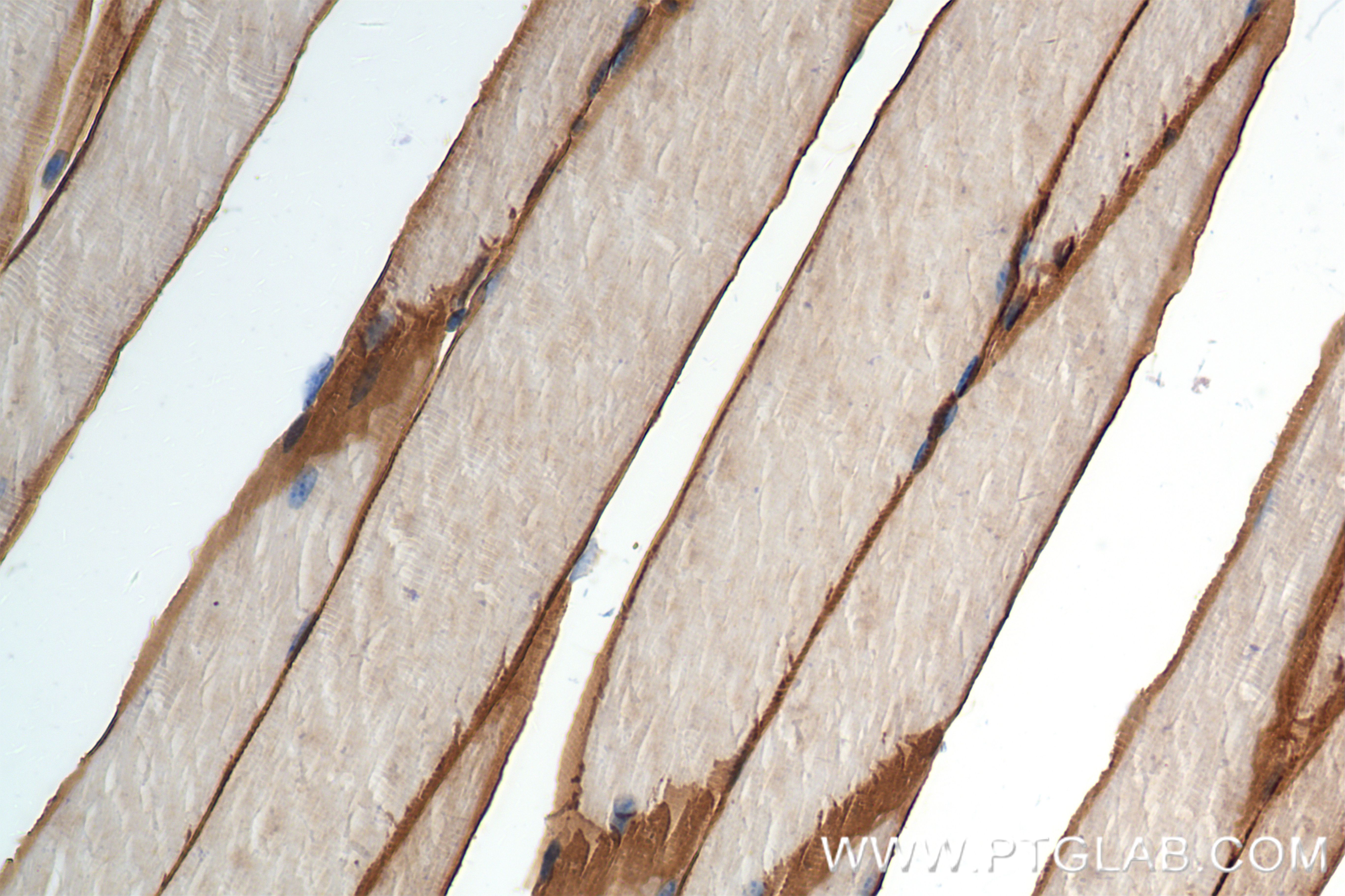 IHC staining of mouse skeletal muscle using 84797-4-RR