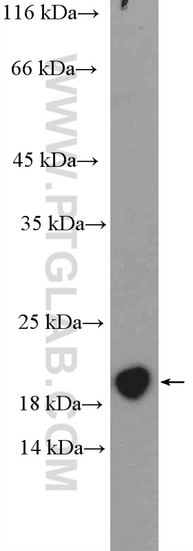 WB analysis of mouse bladder using 14984-1-AP