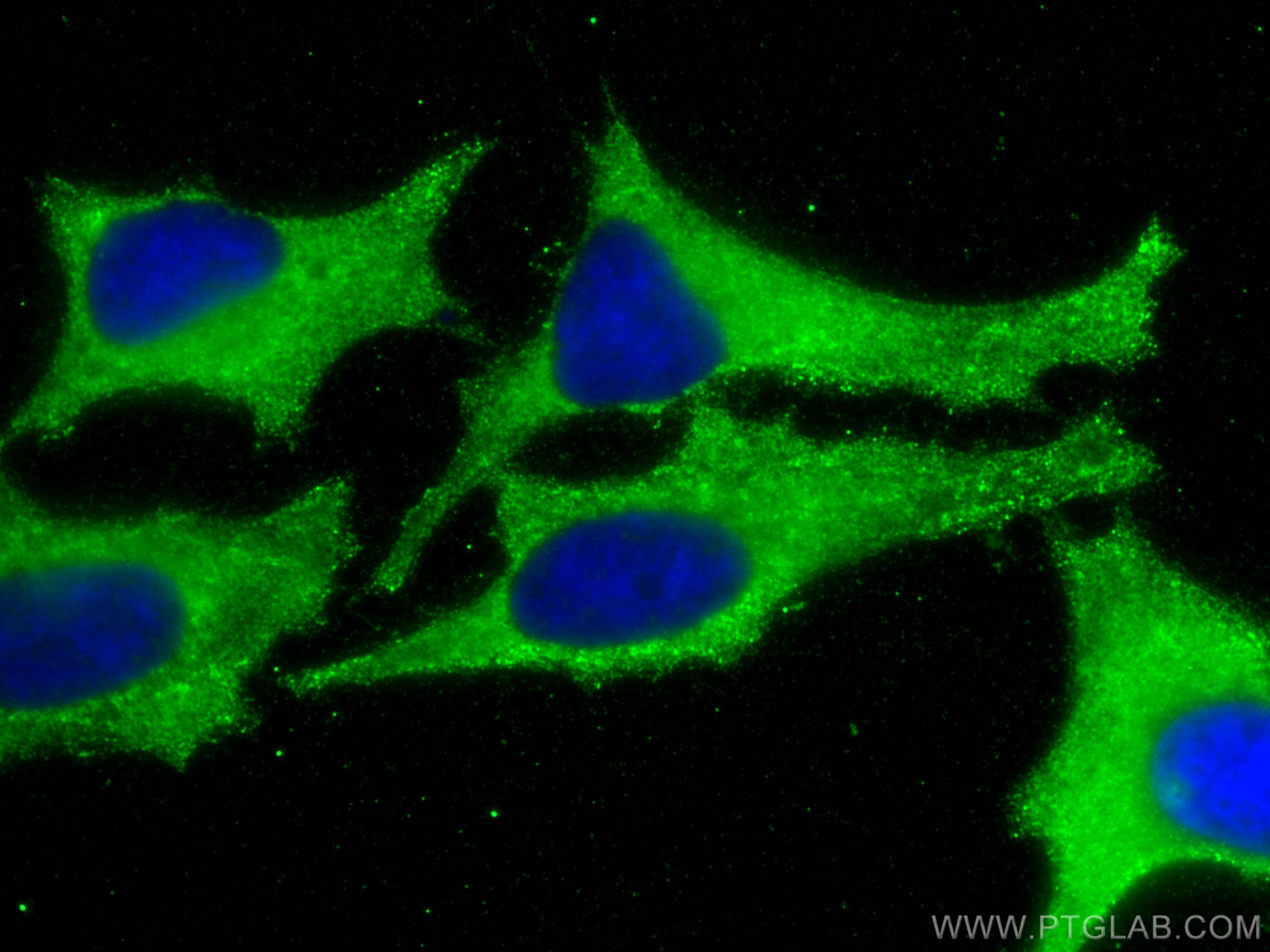 IF Staining of HeLa using 68360-1-Ig (same clone as 68360-1-PBS)