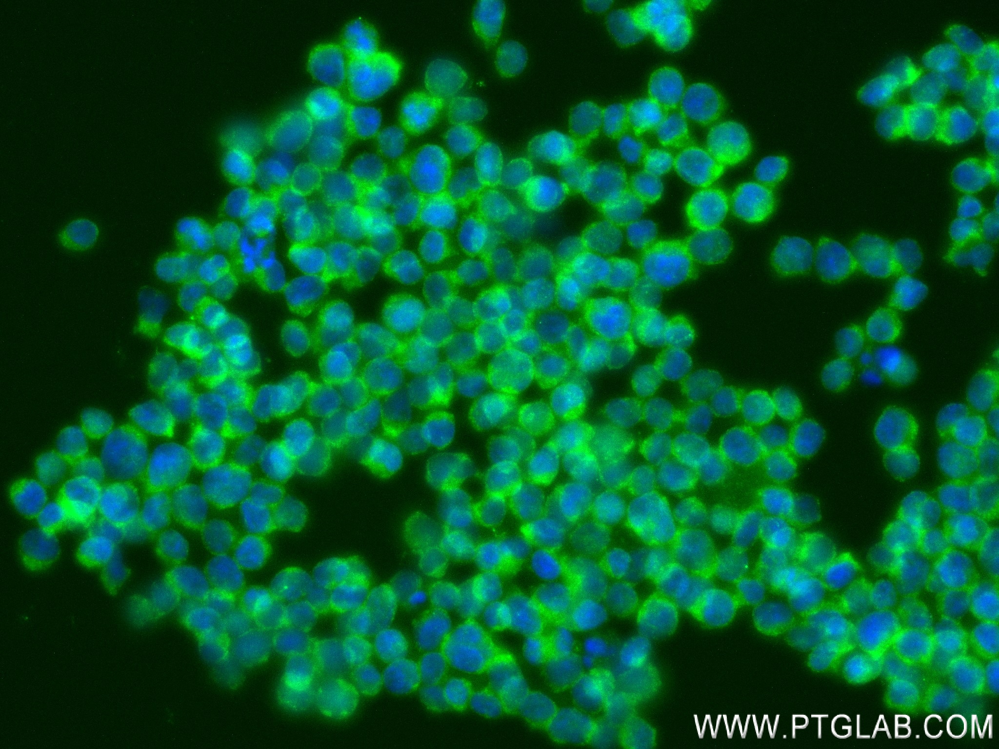 IF Staining of Jurkat using 84312-5-RR