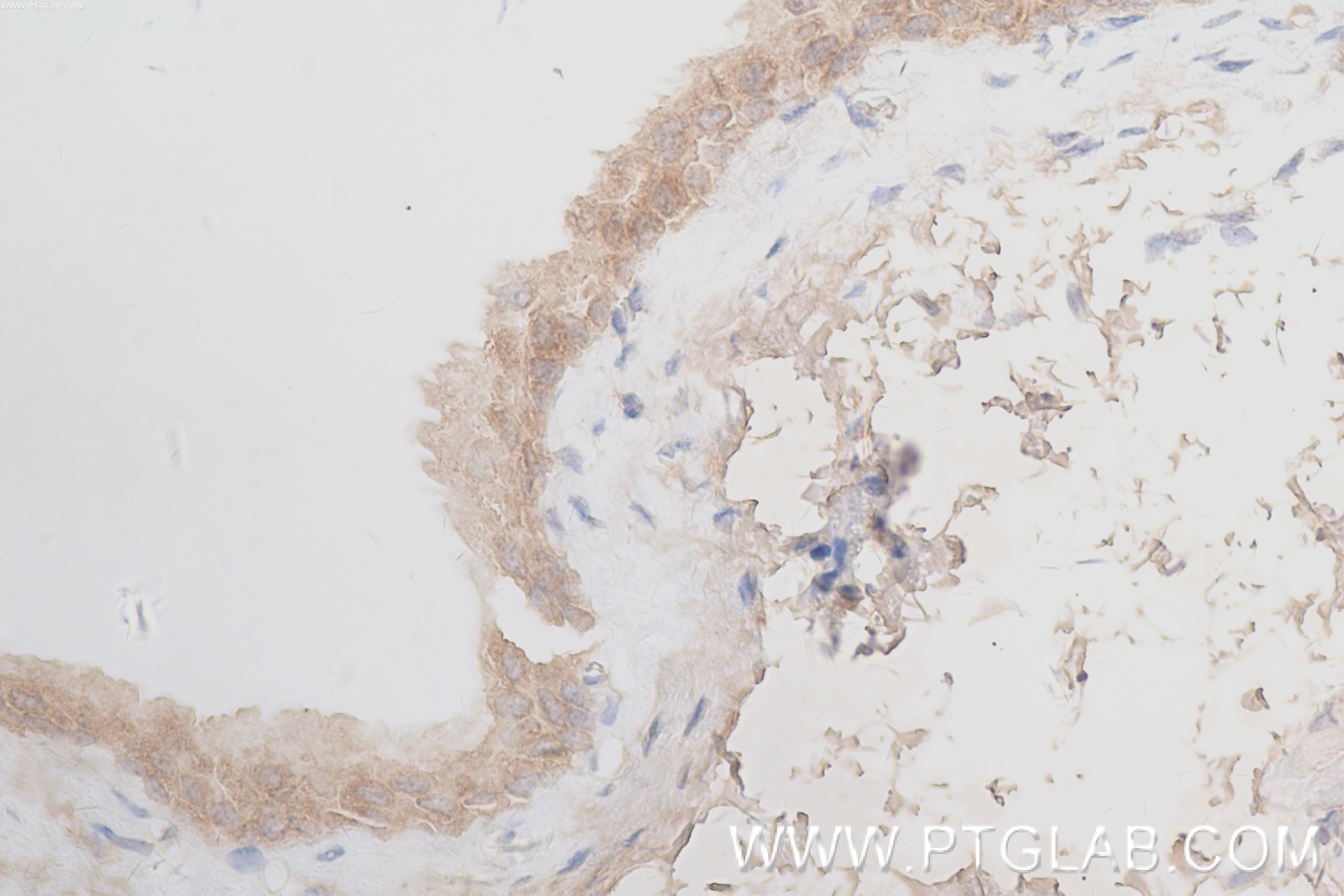 IHC staining of mouse bladder using 84312-5-RR