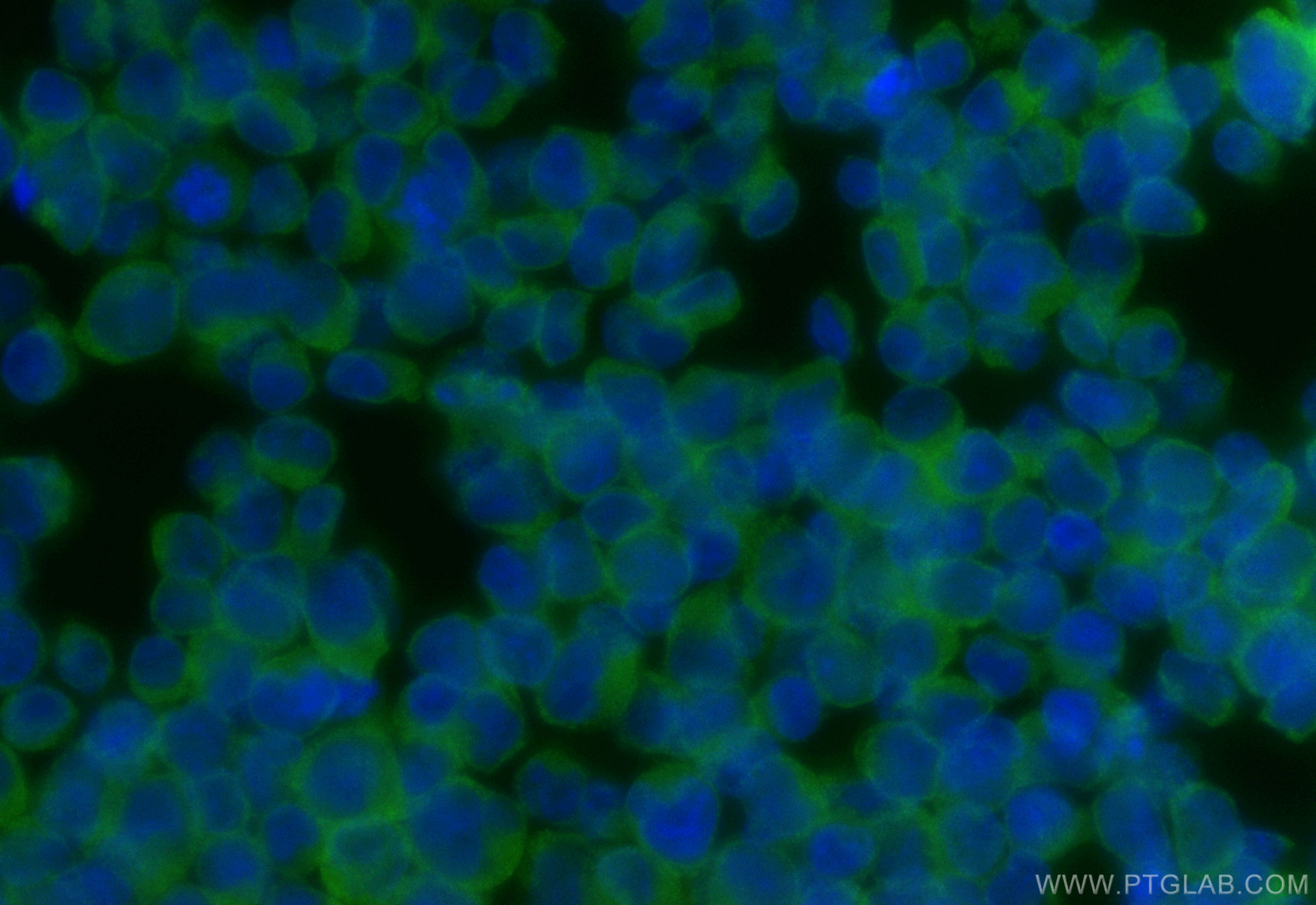 IF Staining of Jurkat using CL488-84312-5