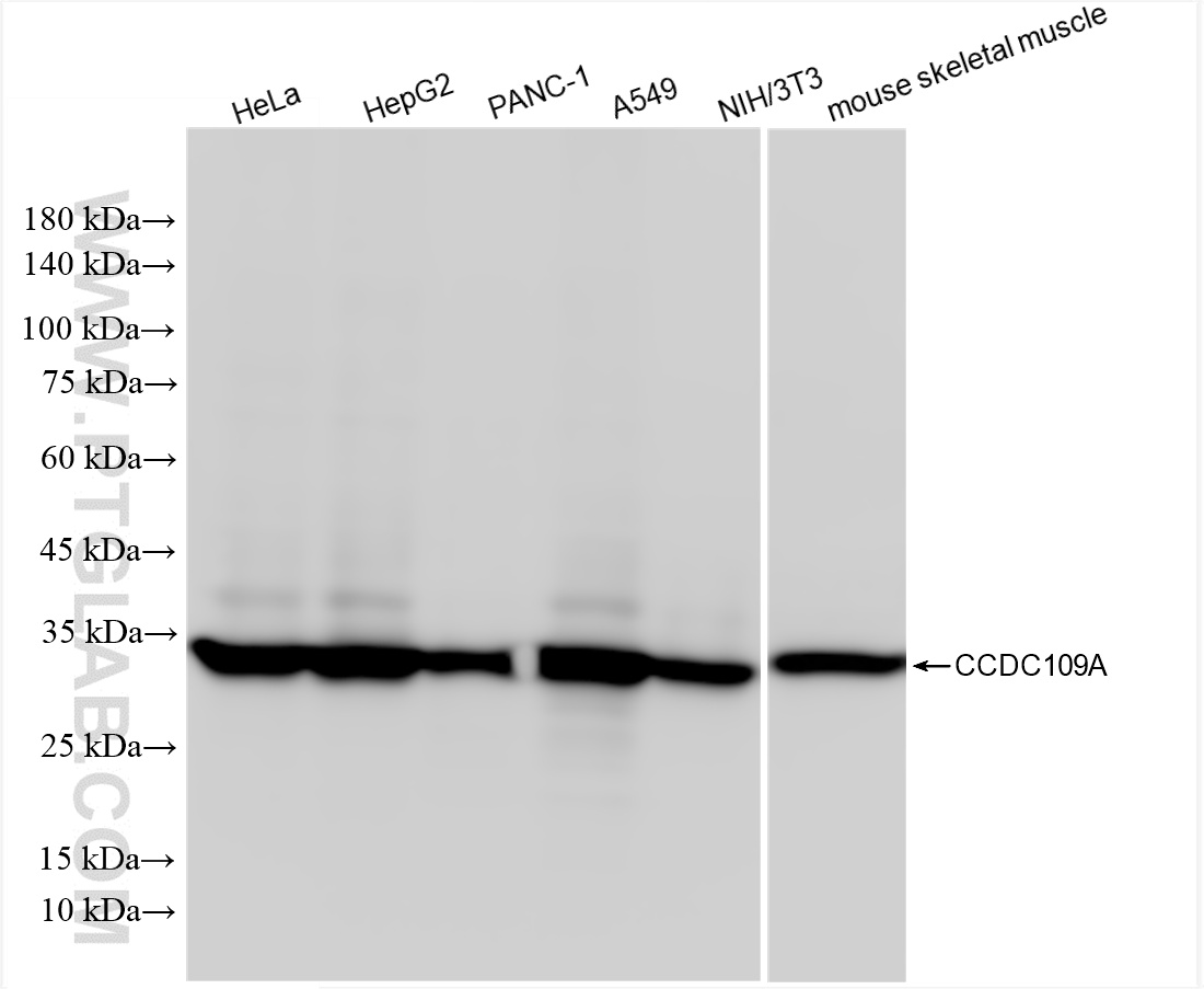 Various lysates were subjected to SDS PAGE followed by western blot with 86274-1-RR (CCDC109A antibody) at dilution of 1:10000 incubated at room temperature for 1.5 hours. WB analysis using 86274-1-RR