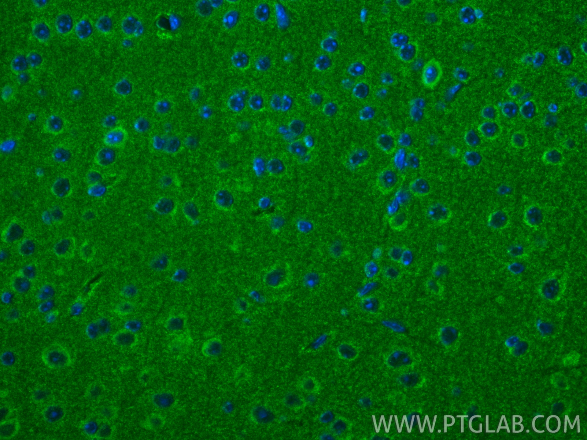 IF Staining of mouse brain using 24948-1-AP (same clone as 24948-1-PBS)