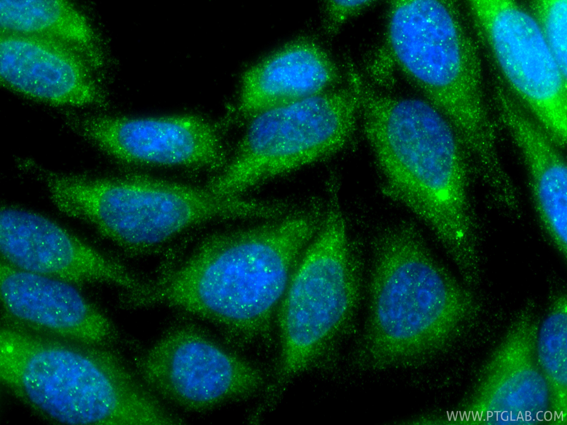 IF Staining of HepG2 using 24948-1-AP IF Staining of HepG2 using 24948-1-AP