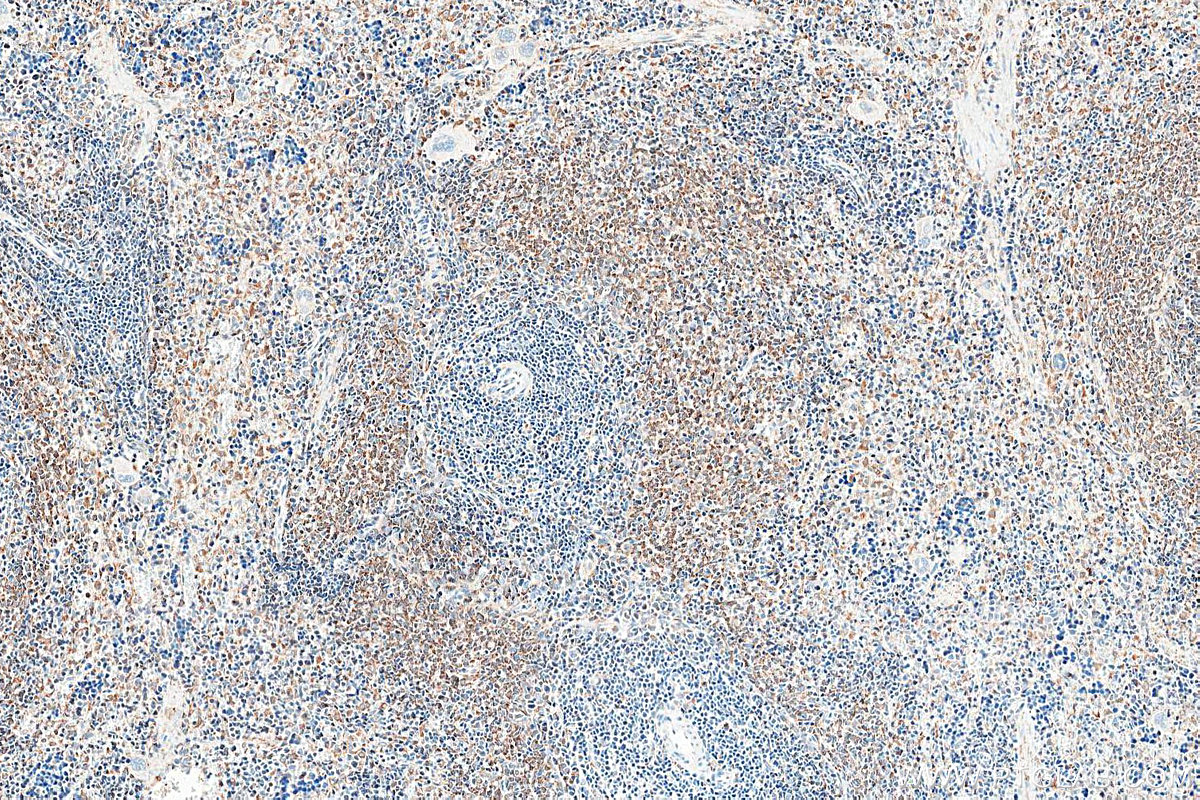 IHC staining of rat spleen using 34213-1-AP IHC staining of rat spleen using 34213-1-AP