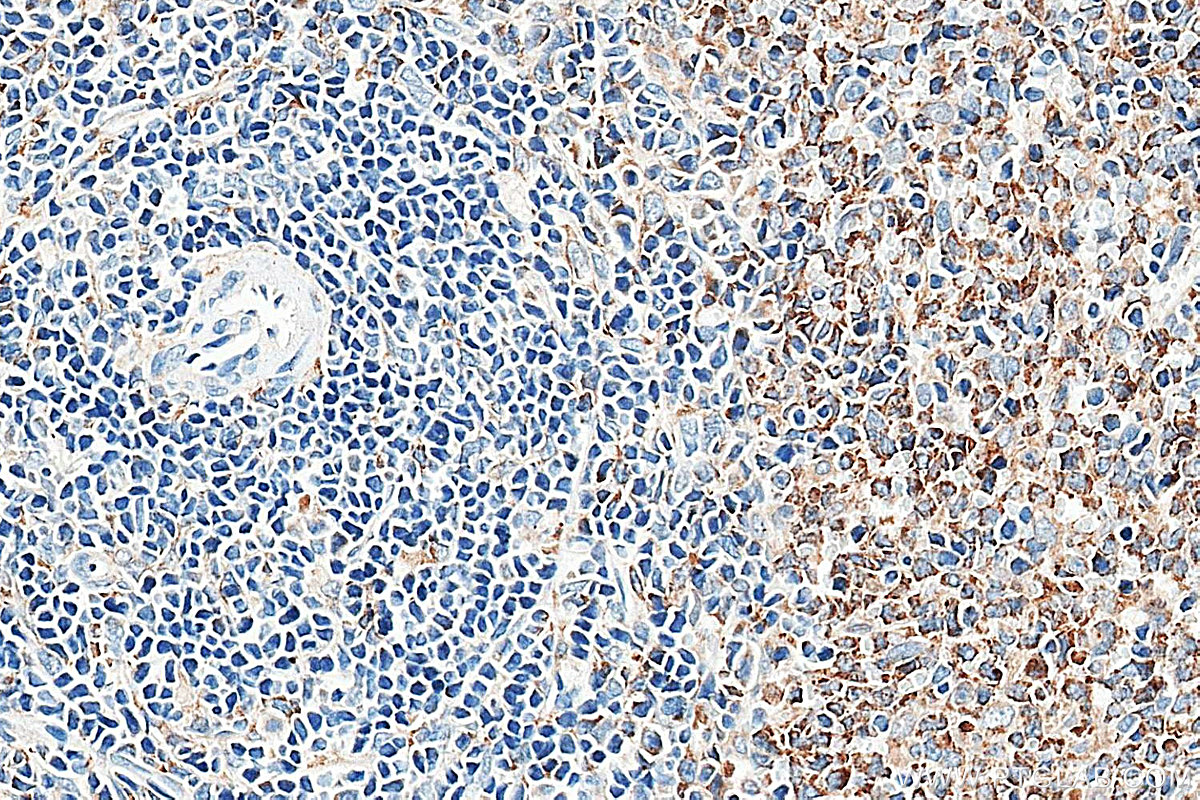 IHC staining of rat spleen using 34213-1-AP IHC staining of rat spleen using 34213-1-AP