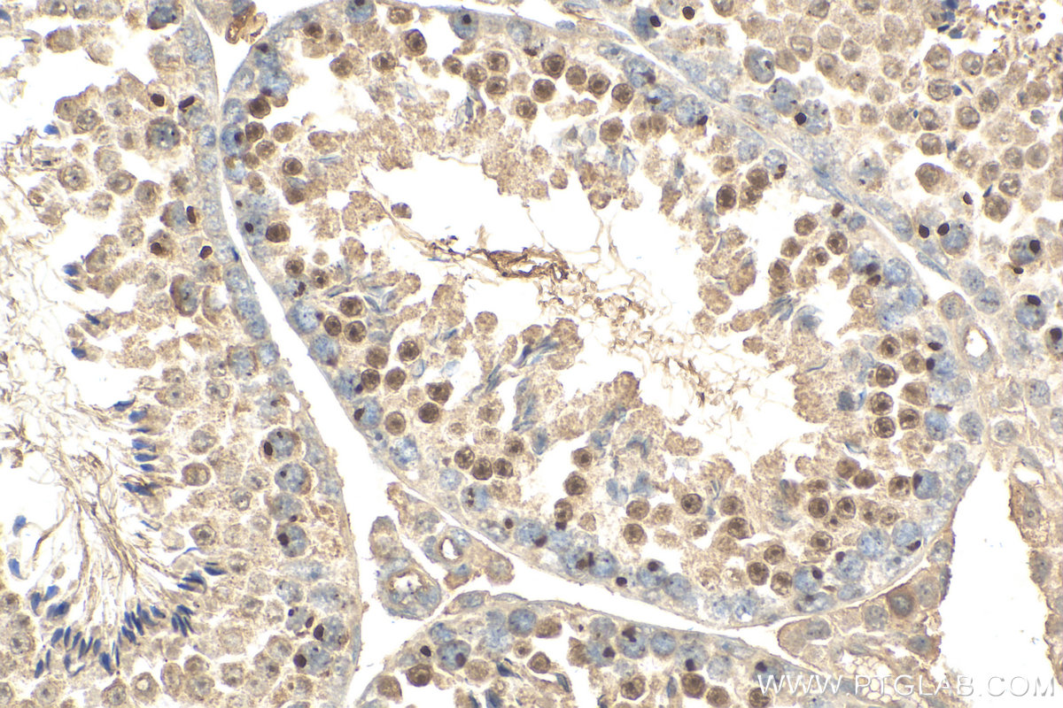 IHC staining of mouse testis using 24721-1-AP