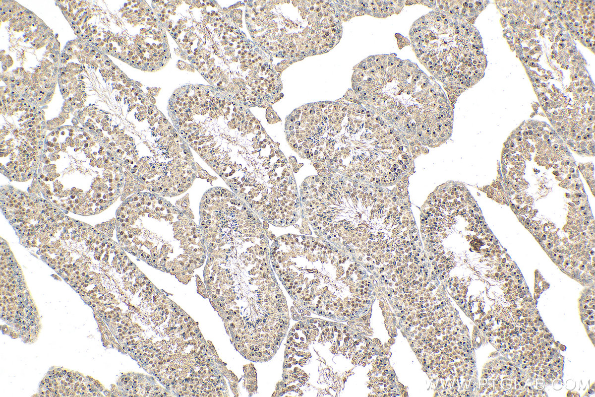 IHC staining of mouse testis using 24721-1-AP
