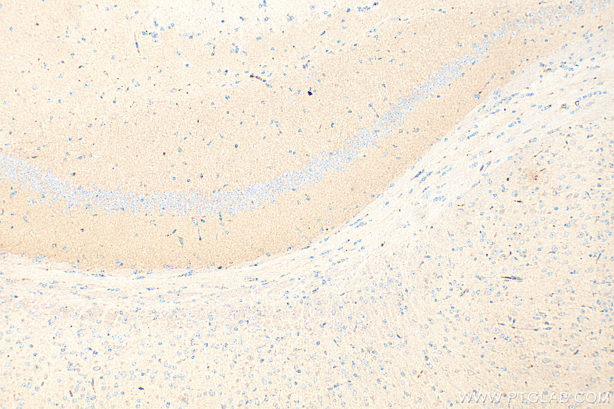 Immunohistochemical analysis of paraffin-embedded mouse brain tissue slide using 33775-1-AP (MDGA1 antibody) at dilution of 1:400 (under 10x lens). Heat mediated antigen retrieval with Tris-EDTA buffer (pH 9.0). IHC staining of mouse brain using 33775-1-AP