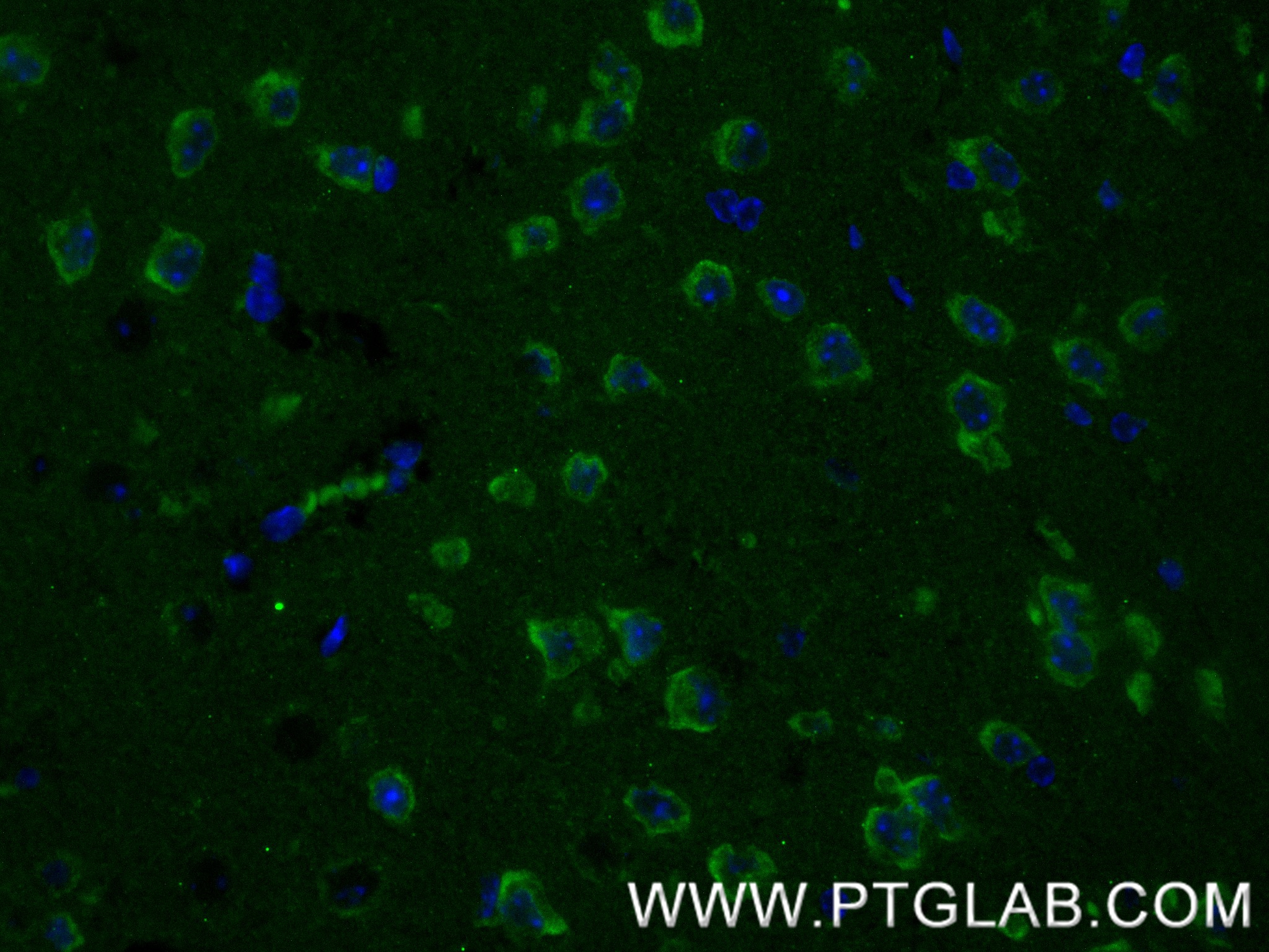 IF Staining of mouse brain using 87078-1-RR (same clone as 87078-1-PBS) IF Staining of mouse brain using 87078-1-RR (same clone as 87078-1-PBS)